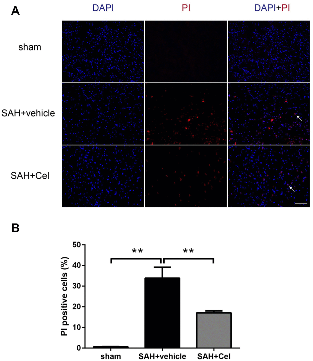 Effects of celastrol on cell injury in the ipsilateral basal cortex at 72 h after SAH induction. (A) Representative microphotographs showed the co-localization of DAPI (blue) with PI (red) positive cells in the ipsilateral basal cortex at 72 h after SAH induction. (B) Quantitative analysis of PI positive cells at 72 h after SAH induction. Data were presented as mean±SEM. n = 6. **P 