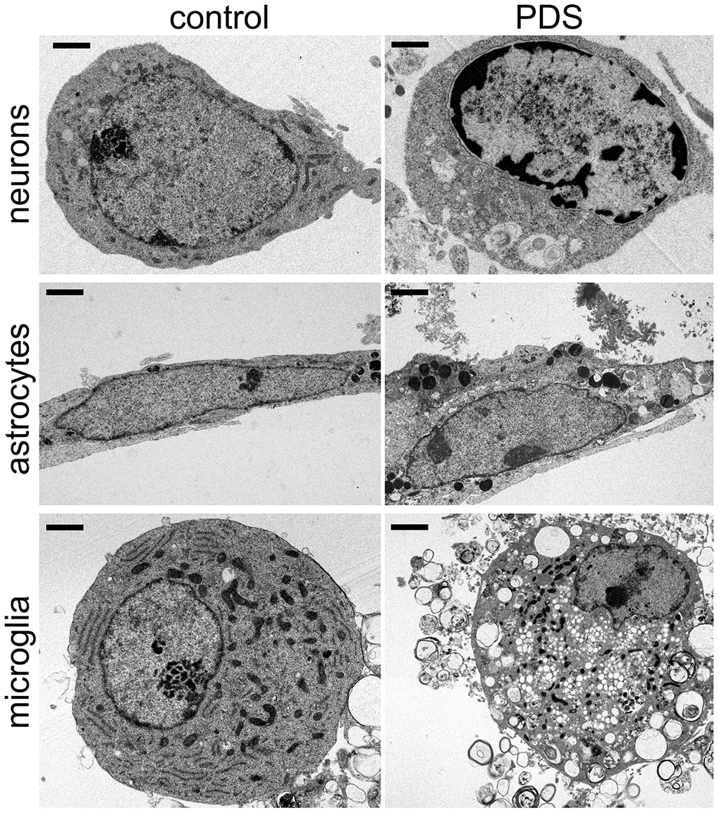 PDS alters the structure of chromatin and cytoplasm in primary neurons, astrocytes, and microglia. Representative electron micrographs of cultured cortical neurons, astrocytes, and microglia treated with a vehicle overnight (left panel) and with 2 μM PDS overnight (right panel). Bar (neuronal cells), 1 μm; bar (astrocytes and microglia), 2 μm. Primary cultures were fixed and processed for electron microscopy imaging. Results were pooled from two independent experiments.