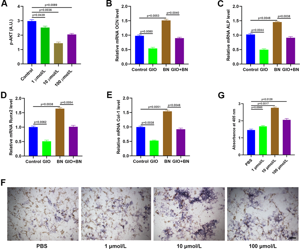 BN treatment partially reverses GIO by suppressing AKT. (A) ELISA analysis shows phospho-AKT levels in GIO-induced MC3T3-E1 cells treated with BN (1μM, 10 μM, and 100 μM). (B–E) QRT-PCR analysis shows expression levels of bone turnover markers (ALP, OCN, Runx2, and Col 1) in GIO model MC3T3-E1 cells treated with BN (10 μM, 10 μM, and 100 μM BN). (F, G) ALP staining results of GIO model MC3T3-E1 cells treated with BN (1μM, 10 μM, and 100 μM). The data are represented as means±SD of at least 3 independent experiments.