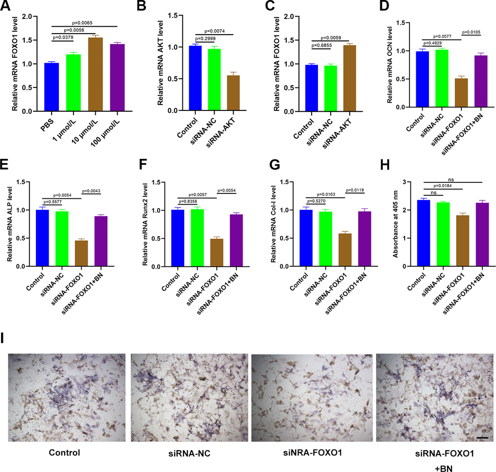 BN regulates osteogenesis via AKT/FOXO1 signaling. (A) QRT-PCR analysis shows FOXO1 levels in GIO model MC3T3-E1 cells treated with BN (1μM, 10 μM, and 100 μM). (B) QRT-PCR analysis shows AKT mRNA levels in control-siRNA- and AKT siRNA-transfected MC3T3-E1 cells. (C) QRT-PCR analysis shows the levels of FOXO1 in control-siRNA- and AKT siRNA-transfected GIO model MC3T3-E1 cells treated with BN (1μM, 10 μM, and 100 μM). (D–G) QRT-PCR analysis shows the levels of bone turnover markers (ALP, OCN, Runx2, and Col 1) in control-siRNA- and AKT siRNA-transfected GIO model MC3T3-E1 cells treated with BN (1μM, 10 μM, and 100 μM). (H, I) ALP staining results of control-siRNA- and AKT siRNA-transfected GIO model MC3T3-E1 cells treated with BN (1μM, 10 μM, and 100 μM). The data are shown as means±SD of 3 independent experiments.