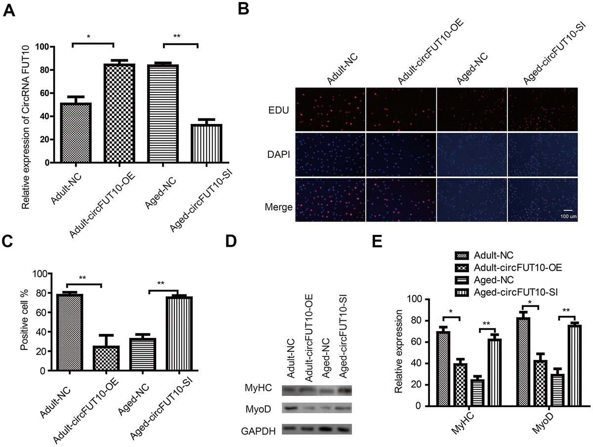Effect of circFUT10 on SkMSC proliferation and differentiation. (A) Adult SkMSCs were transfected with circRNA FUT10 overexpression vector, while aged SkMSCs were transfected with circFUT10 small interfering RNA for circRNA FUT10 knock down. circRNA FUT10 mRNA was analyzed using real-time qPCR. (B) SkMSC proliferation was measured by EdU assays. (C) Quantification of EdU-positive cells. (D) Western blot analysis showing MyHC and MyoD expression in different groups. (E) Quantification of MyHC and MyoD were normalized to β-actin. Each bar represents the mean ± SEM. *P 