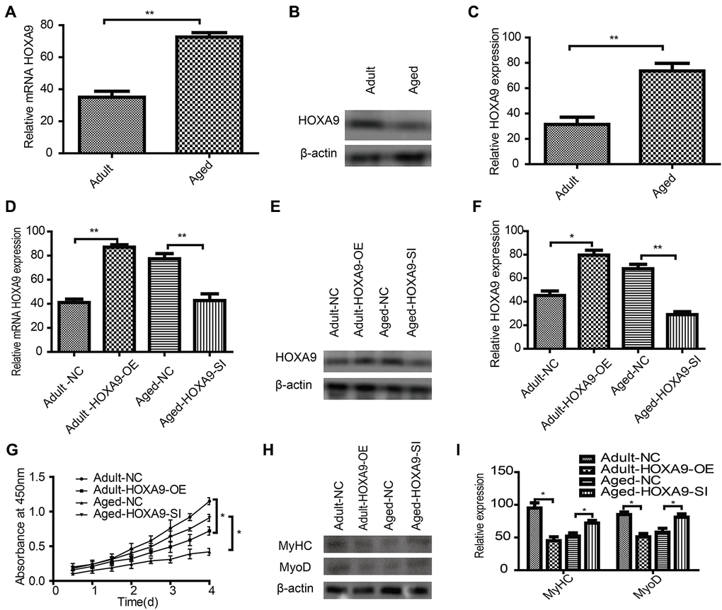 Effect of HOXA9 on proliferation and differentiation of SkMSCs (A) qPCR and (B) western blotting were performed to identify HOXA9 mRNA and protein expression in adult and aged SkMSCs. (C) HOXA9 was normalized to β-actin in adult and aged SkMSCs. (D) qPCR and (E) western blotting were performed to identify HOXA9 mRNA and protein expression in adult SkMSCs transfected with circRNA FUT10 overexpression vector, while aged SkMSCs were transfected with circRNA FUT10 small interfering RNA to knock down circRNA FUT10. (F) HOXA9 was normalized to β-actin in the above groups. (G) MTT assay showing the effect of HOXA9 on adult and aged SkMSC proliferation. (H) Western blotting was performed to identify MyHC and MyoD expression in transfected cells. (I) Quantification of HOXA9 was normalized to β-actin. Each bar represents the mean ± SEM. *P 