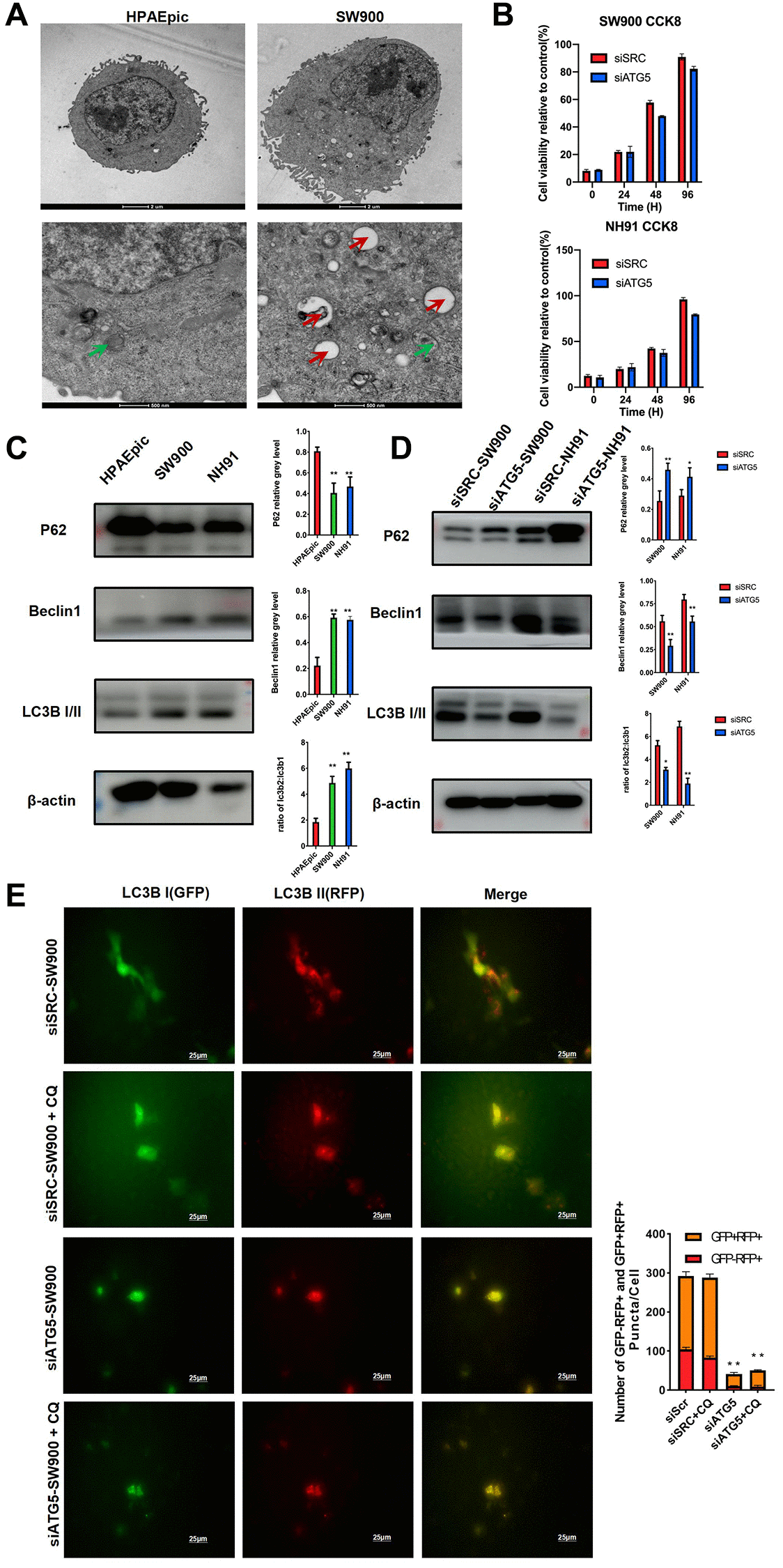 ATG5 down regulation inhibits autophagy in LUSC cells. (A) Representative TEM images showing the formation of autophagosomes (red arrow) and autolysosomes (green arrow) in HPAEpic and SW900. (B) After the transfected with siATG5/SRC, cell viability at different time points were assessed by using an MTT assay. (C) Expression of autophagy relative protein, including P62, Beclin1 and LC3B I/II, were evaluated in HPAEpic, SW900 and NH91cells. (D) Expression of ATG5, P62, Beclin 1, and LC3B I/II in SW900 and NH91 cells transfected with si-ATG5 were detected using a western blot assay. (E) siATG5 and siSRC SW900 cells were transfected with GFP-mRFP-LC3 virus and incubated with or without chloroquine for 24 h and then starved for 2 hours. Red or yellow puncta indicating complete/incomplete autophagy were calculated and reported as the mean ± SD. All the P values were compared with the control *P **P ***P 