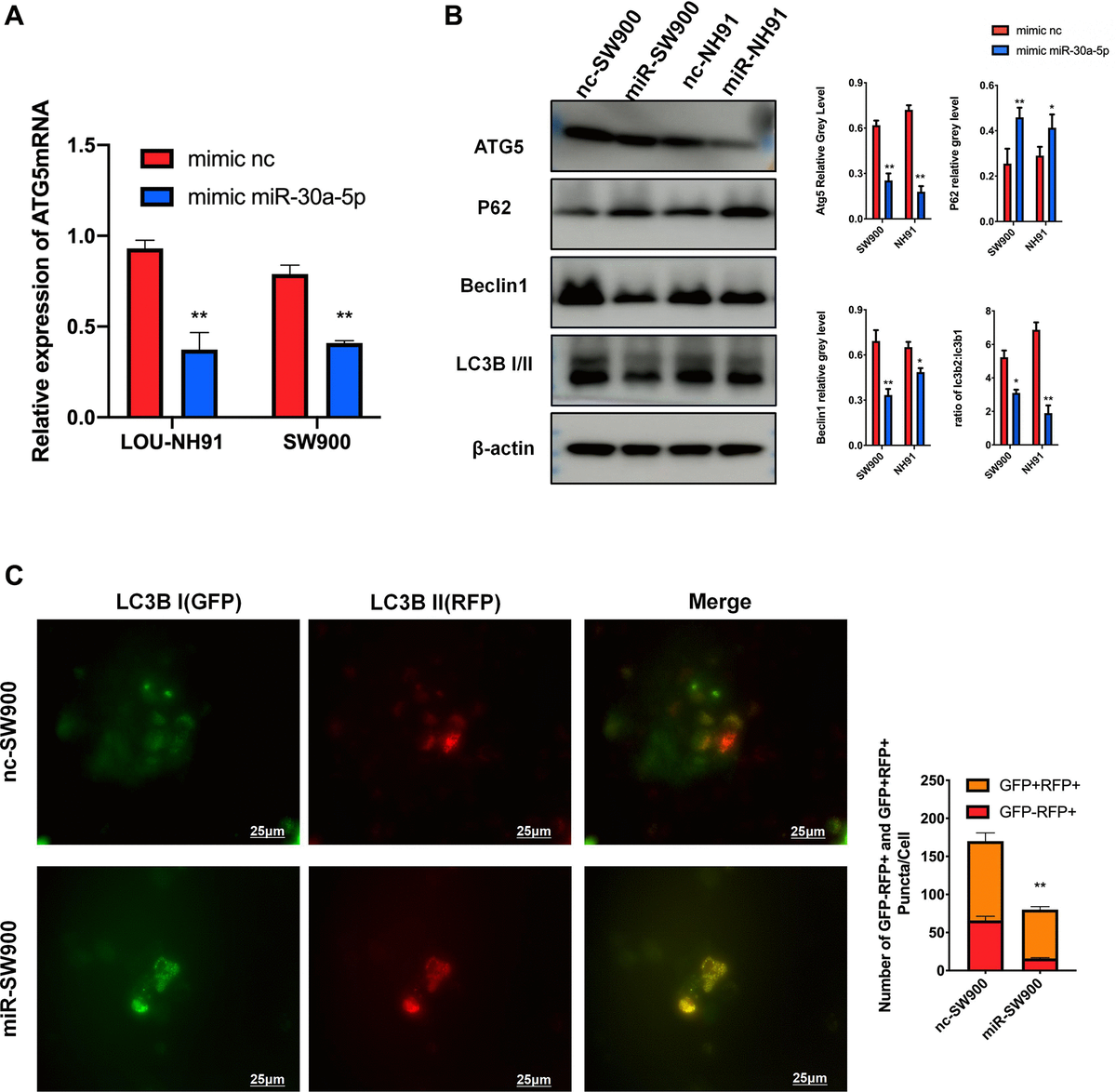miR-30a-5p suppresses ATG5-mediated autophagy in LUSC. (A) The result of mRNA were used to evaluate the effect of miR-30a-5p on ATG5. (B) SW900 and NH91 cells were transfected with mimic NC or mimic miR-30a-5p and then starved for 2 hours to stimulate autophagy. ATG5, P62, Beclin 1, and LC3B I/II expression were evaluated by western blot. (C) GFP-mRFP-LC3 lentivirus was used to evaluate autophagy flux in mimic NC/miR transfected SW900 cells. Red or yellow puncta indicating complete/incomplete autophagy were calculated and reported as the mean ± SD. All the P values were compared with the control *P **P ***P 