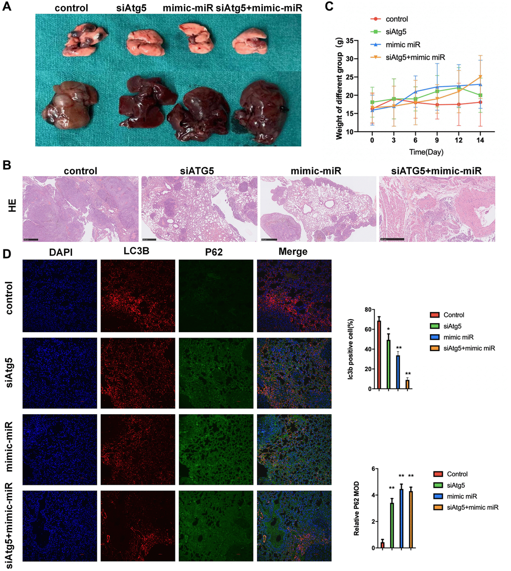 Attenuation of miR-30a-5p/ATG5-regulated autophagy inhibits LUSC progression in lung metastatic model. (A) Mice were administered WT/siATG5/mimic miR-30a-5p/siATG5+mimic miR-30a-5p transfected SW900 cells (5 × 105/mouse) by i.p injection. Image representative gross appearance of lungs and livers from control (n = 3), siATG5 (n = 3), mimic miR-30a-5p (n = 3) and siATG5+mimic miR-30a-5p (n = 3) mice. (B) HE staining images of pulmonary metastatic samples in different group. (C) The body weight of mice in different groups. (D) Representative images of tumors from lung using immunofluorescence staining against DAPI P62, and LC3B. All the P values were compared with the control. *P **P 