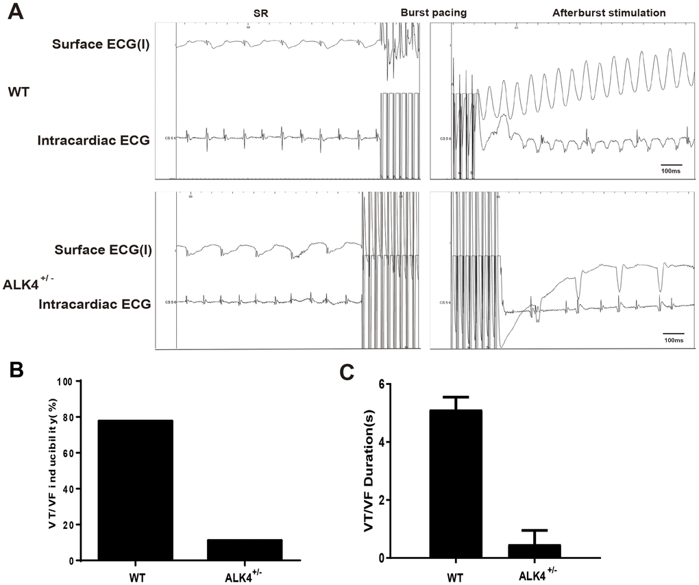 ALK4 haplodeficiency ameliorates pacing-induced ventricular arrhythmias in MI mice. (A) Representative surface ECGs and intracardiac images of intracardiac electrical stimulation of WT and ALK4+/- MI mice. (B, C) VT/VF inducibility (B) and duration (C) of WT and ALK4+/- MI mice (n≥4).
