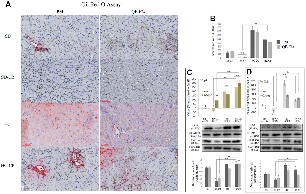 Lipid content determination in PM and QF-VM of the experimental animal model. Representative images of lipid content stained with the oil red O technique (A). Scale bar: 100 μm. SD (n=6), SD-CR (n=8), HCD (n=9), and HCD-CR (n=12). The total area stained with Oil red O (B). Fabp4 (C) and Perilipin (D) were used to predict inter- (INTM) and intra-myocellular (IM) fat infiltration. Fabp4 and Perilipin were analyzed by qPCR (mRNA) and expressed as %, the SD value was set to 0, and the compared samples were normalized to this level. Positive % values represent upregulation. Negative values represent downregulation. Protein expression of Fabp4 and Perilipin was obtained by Western Blot analysis and quantified with Image Lab 6.1 software. SD expression was set to 1 and the relative protein levels were normalized as a ratio of GAPDH expression. The data are the mean ± s.d. *P 