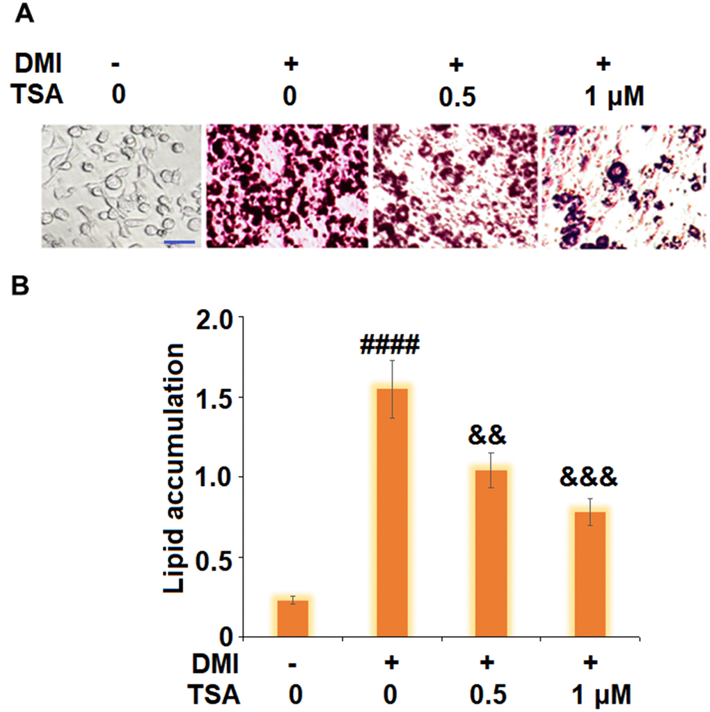 TSA inhibits adipogenesis of 3T3-L1 cells. Cells were incubated with a differentiation cocktail (DMI) medium with TSA (0.5 and 1 μM). (A) Cells were stained with Oil Red O on day 8; (B) Lipid accumulation was examined by measuring absorbance at 540 nm of Oil Red O staining. Scale bar, 100 μm (n=5-6, ####, P