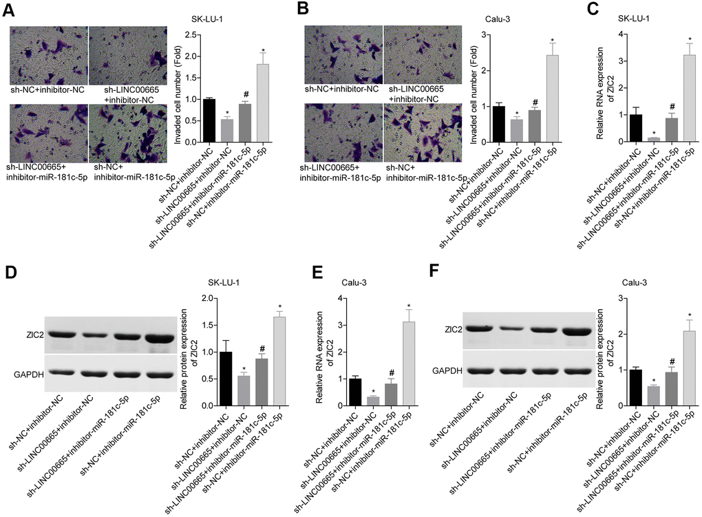 Assessment of the function of LINC00665/miR-181c-5p axis in regulating LUAD cell invasion and ZIC2 expression. (A, B) Transwell chambers were applied for cell invasion assessment in sh-NC + inhibitor-NC, sh-LINC00665 + inhibitor-NC, sh-LINC00665 + inhibitor-miR-181c-5p, sh-NC + inhibitor-miR-181c-5p groups. (C, E) The mRNA level of ZIC2 was detected by RT-PCR technology. (D, F) The protein level of ZIC2 was measured by western blotting technology. (*p0.05, vs. sh-NC + inhibitor-NC group; #p0.05, vs. sh-LINC00665 + inhibitor-NC group).