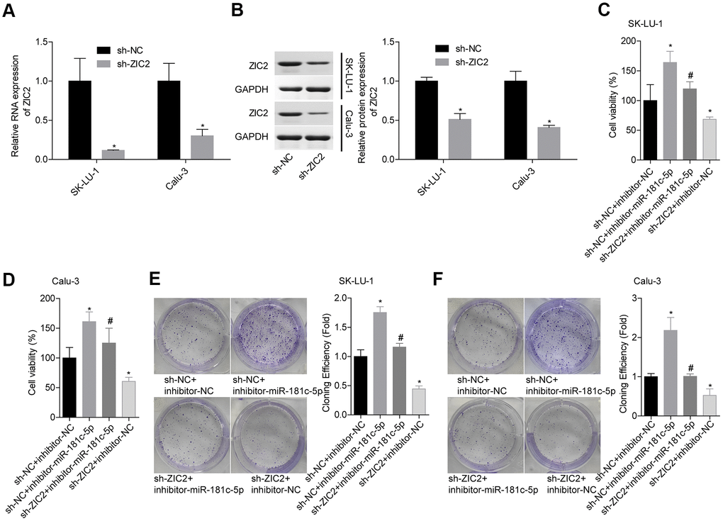 Knockdown of miR-181c-5p inhibited LUAD cell growth via targeting ZIC2. (A, B) The knockdown efficiencies of sh-ZIC2 at mRNA and protein levels were detected by RT-PCR and western blotting technologies. Then, SK-LU-1 and Caki-1 cells with sh-NC + inhibitor-NC, sh-NC + inhibitor-miR-181c-5p, sh-ZIC2 + inhibitor-miR-181c-5p or sh-ZIC2 + inhibitor-NC stable transfection were harvested and submitted to the following experiments. (C, D) Cell viability was assessed by CCK-8 assay. (E, F) Cell clone formation was detected by clone formation assay. (*p0.05, vs. sh-NC + inhibitor-NC group; #p0.05, vs. sh-NC + inhibitor-miR-181c-5p group).