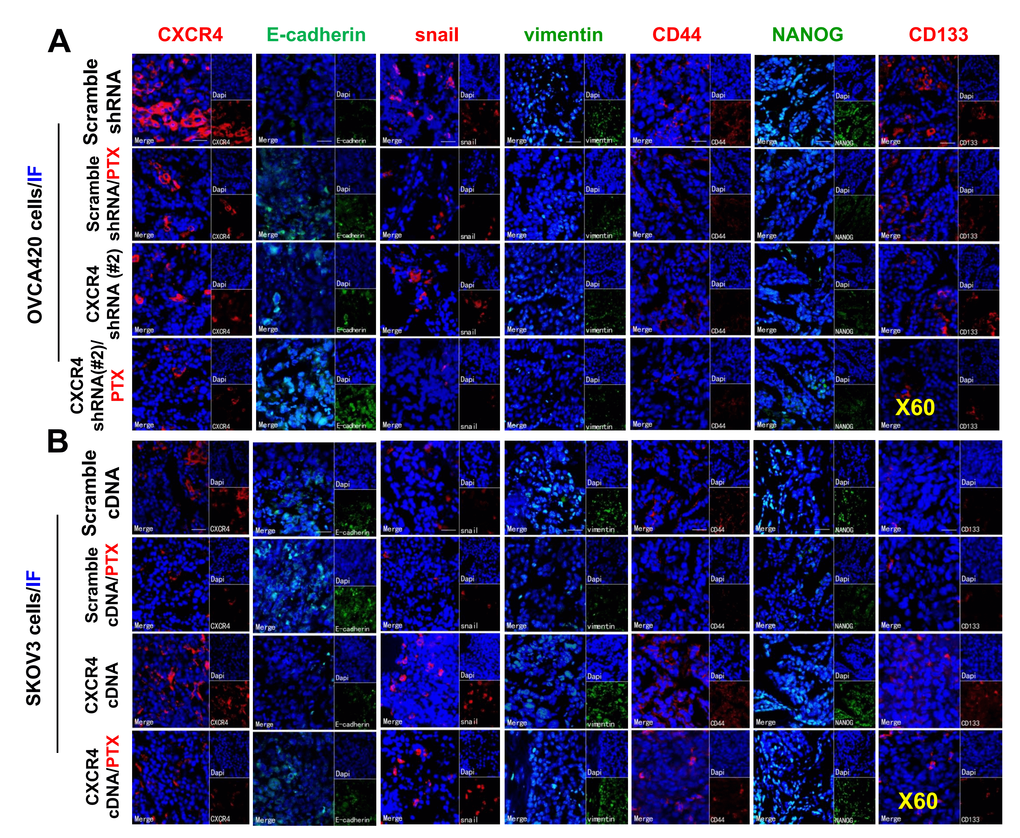 Further ex vivo IF examining the expression of CXCR4, EMT- and CSC-related proteins in the OVCA420 and SKOV3 cell xenograft tissues from the tumours nude mice following treatment with PTX. Immunofluorescent (IF) staining analysis images illustrated the location of CXCR4, EMT-, and CSC-related protein expressions in the OVCA420 (A) and SKOV3 (B) cell xenograft tumour tissues. Notably, red fluorescence shows the membrane expression of CXCR4, snail, CD44, and CD133; green fluorescence shows the membrane expression of E-cadherin, vimentin, and NANOG; and blue fluorescence shows all cell nuclei stained with DAPI (4′, 6-diamidino-2-phenylindole). Data represent one of the three independent experiments with similar results. Scale bars=50 μm.