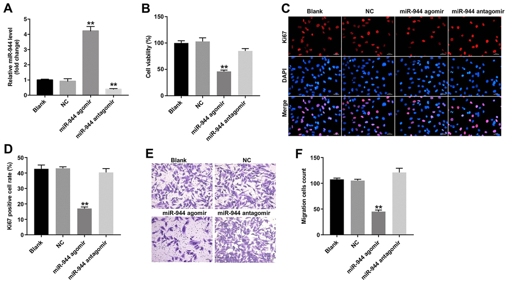 Overexpression of miR-944 inhibits proliferation and migration of HUVECs. (A) RT-qPCR analysis shows miR-944 expression in blank control, and agomiR-NC, agomiR-944, and antagomiR-944-transfected HUVECs. (B) CCK-8 assay results show viability of blank control, agomiR-NC-, agomiR-944-, and antagomiR-944-transfected HUVECs. (C, D) Immunofluorescence assay results demonstrate staining of blank control, and agomiR-NC-, agomiR-944-, and antagomiR-944-transfected HUVECs with anti-Ki67 antibody to determine the percentage of Ki67-positive HUVECs. Note: Ki67 is a proliferation marker. (E, F) Transwell migration assay results demonstrate the migration ability of blank control, and agomiR-NC-, agomiR-944-, and antagomiR-944-transfected HUVECs. **P 