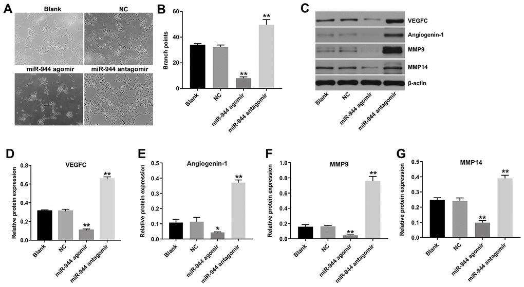 Overexpression of miR-944 inhibits angiogenesis of HUVECs. (A, B) Tube formation assay results show the number of branch points as an index of angiogenesis in blank control, and agomiR-NC-, agomiR-944-, and antagomiR-944-transfected HUVECs. (C–G) Western blot analysis shows the relative expression levels of (C, D) VEGF, (C, E) angiogenin-1, (C, F) MMP9, and (C, G) MMP14 proteins in blank control, and agomiR-NC, agomiR-944, and antagomiR-944-transfected HUVECs. *P 