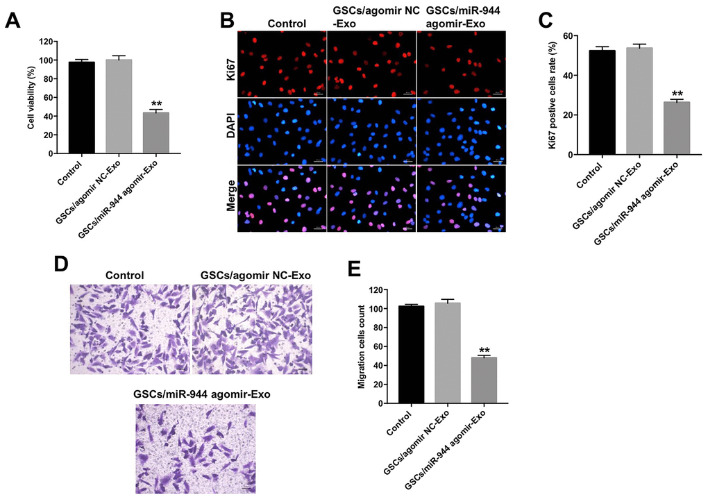 Exosomal miR-944 derived from GSCs suppresses proliferation and migration of HUVECs. (A) CCK-8 assay results show viability of HUVECs co-cultured with GSCs/agomiR-NC-Exo and GSCs/agomiR-944-Exo for 24 h. (B, C) Immunofluorescence assay results show the proliferation status of HUVECs co-cultured with GSCs/ agomiR-NC-Exo and GSCs/agomiR-944-Exo for 24 h based on Ki-67 staining. (D, E) Transwell assay results show the migration ability of HUVECs co-cultured with GSCs/agomiR-NC-Exo and GSCs/agomiR-944-Exo for 24 h. **P 