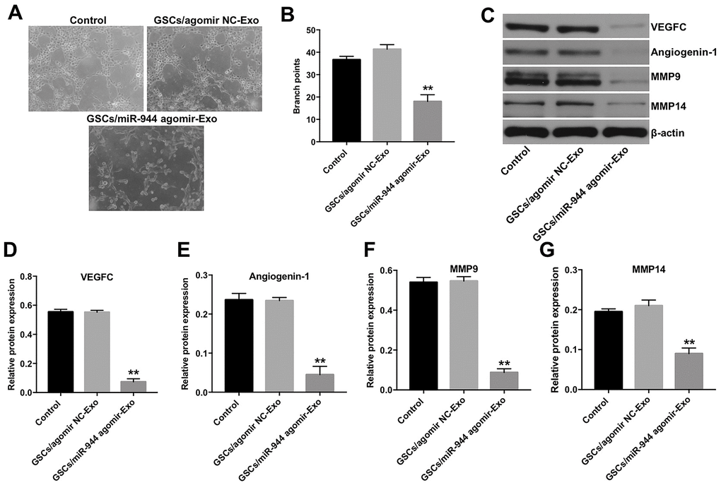 Exosomal miR-944 derived from GSCs suppresses angiogenesis of HUVECs. (A, B) Tube formation assay results show the number of branch points as an index of angiogenesis in HUVECs co-cultured with GSC/agomiR-NC-Exo and GSC/agomiR-944-Exo for 24 h. (C–G) Western blot analysis shows levels of (C, D) VEGF, (C, E) angiogenin-1, (C, F) MMP9, and (C, G) MMP14 in HUVECs co-cultured with GSC/agomiR-NC-Exo and GSC/agomiR-944-Exo for 24 h. β-actin was used as an internal control. **P 