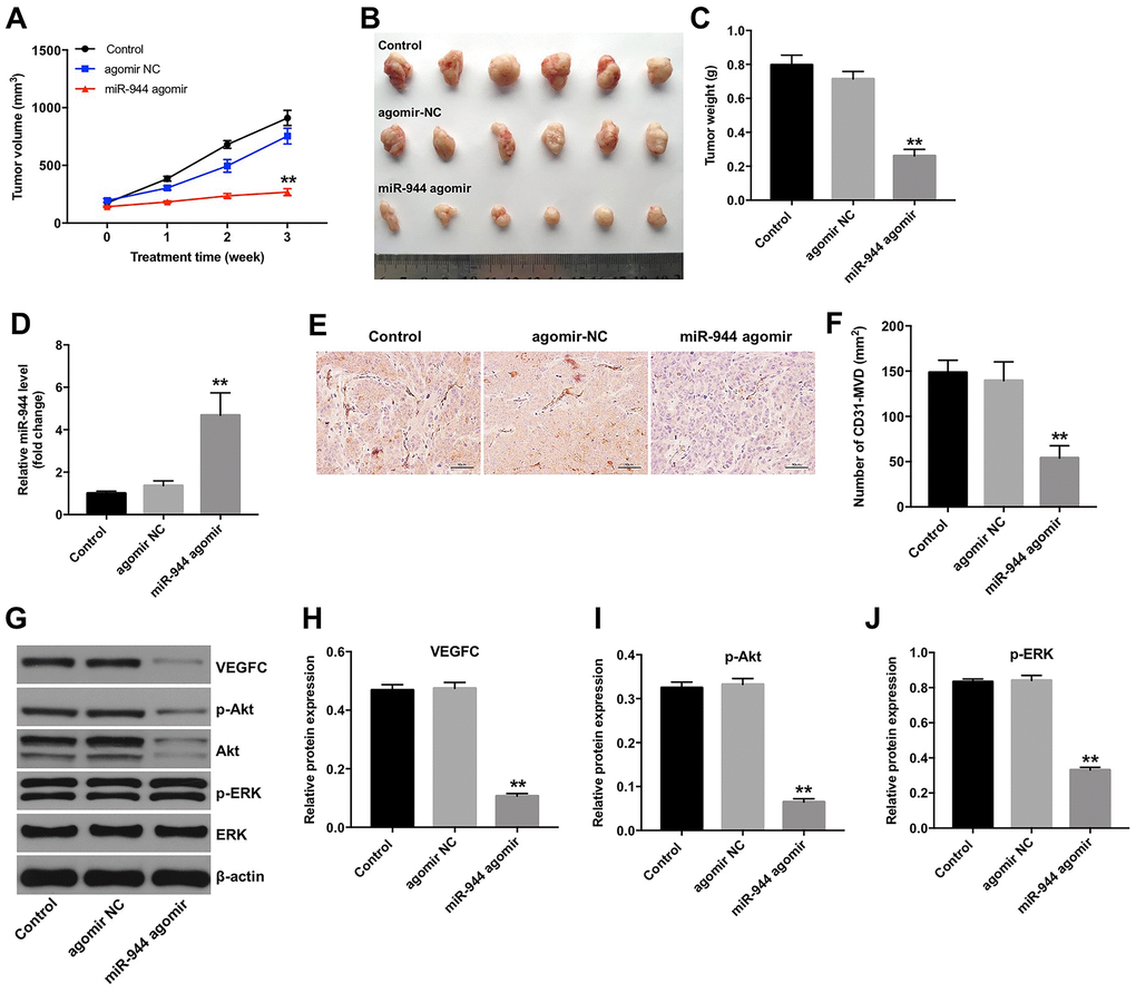 Overexpression of miR-944 inhibits in vivo xenograft glioma cell tumor growth and angiogenesis. (A) The line graph shows tumor volumes on weeks 1-3 in control, agomiR-NC, and agomiR-944 group nude mice. (B) The photographs show xenograft glioma cell tumors harvested at four weeks from control, agomiR-NC, and agomiR-944 group nude mice. (C) The histogram shows the weights of xenograft glioma cell tumors harvested at four weeks from control, agomiR-NC, and agomiR-944 group nude mice. (D) RT-qPCR analysis shows miR-944 levels in the xenograft glioma cell tumor tissues harvested from nude mice belonging to the control, agomiR-NC, and agomiR-944 groups. (E, F) IHC staining results show CD31-stained xenograft glioma cell tumor tissues harvested from nude mice belonging to the control, agomiR-NC, and agomiR-944 groups. Microvessel density (MVD) was analyzed based on CD31+ve staining. (G–J) Western blot analysis shows the levels of VEGFC, p-Akt, Akt, p-ERK, and ERK proteins in the xenograft glioma cell tumor tissues harvested from control, agomiR-NC, and agomiR-944 groups. VEGFC, p-Akt, and p-ERK levels were normalized to β-actin, Akt and ERK levels, respectively. **P 