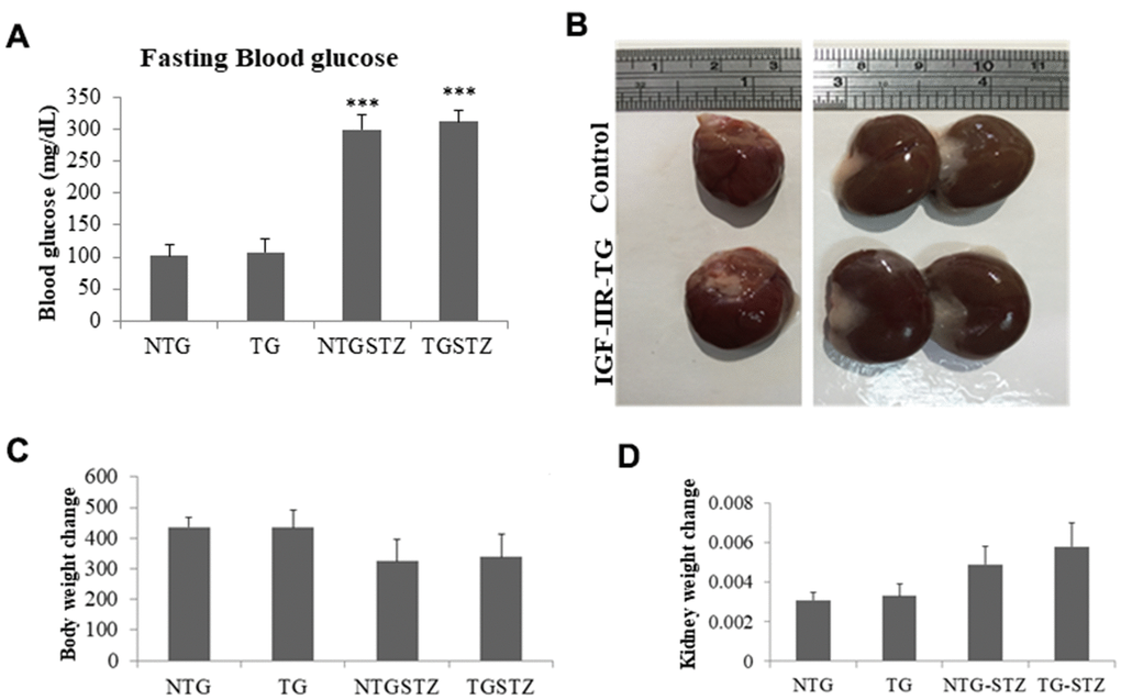Effects of cardiac specific IGFIIRα overexpressing DM rats on kidney weight. (A) Fasting blood glucose levels in Non-transgenic rats (n=6, NTG), transgenic (n=6, TG), NTG-streptozotocin induced diabetes model (n=6, NTGSTZ) and TG streptozotocin induced diabetes model (n=6, TGSTZ). (B) Cardiac specific IGF-IIRα overexpression causes hypertrophy of heart correlated with enlarged kidneys. (C) Changes in body weight and (D) Changes in kidney weight among NTG, TG, NTGSTZ, TGSTZ. *** p