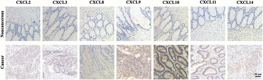 The expression protein of CXCL2/3/8/9/10/11/14 in CRC tissues and noncancerous tissues (IHC).