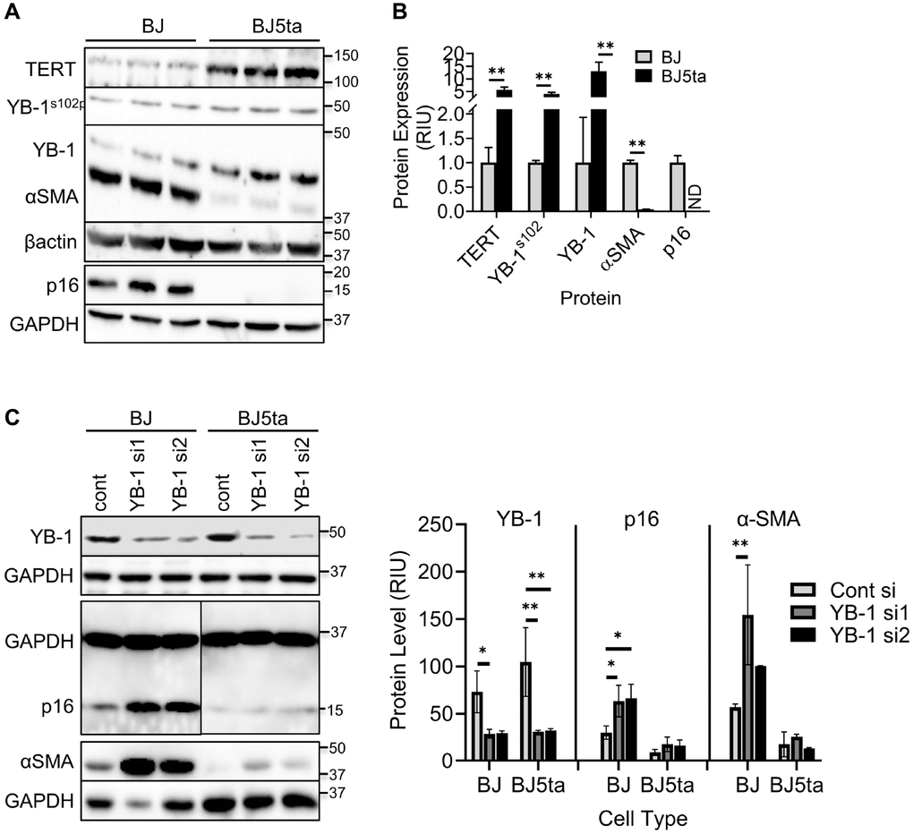 TERT enhanced YB-1 expression and phosphorylation was associated with repression of ACTA2 gene expression. (A) Expression of TERT, αSMA, p16, YB-1 and phosphorylated YB-1 (YB-1S102P) in whole cell lysates was analyzed by western blotting and the results of quantitative analysis shown as relative integration units (RIU) (B). β-actin or GAPDH was used as the internal control. ND, not detected. N = 3 each group in (B). (C) Control or YB-1 siRNA transfected BJ or BJ5ta cells were analyzed for expression of indicated proteins by western blotting, and the corresponding quantified protein levels are shown in the right panel. Representative blots from 3 separate experiments are shown. *P **P 