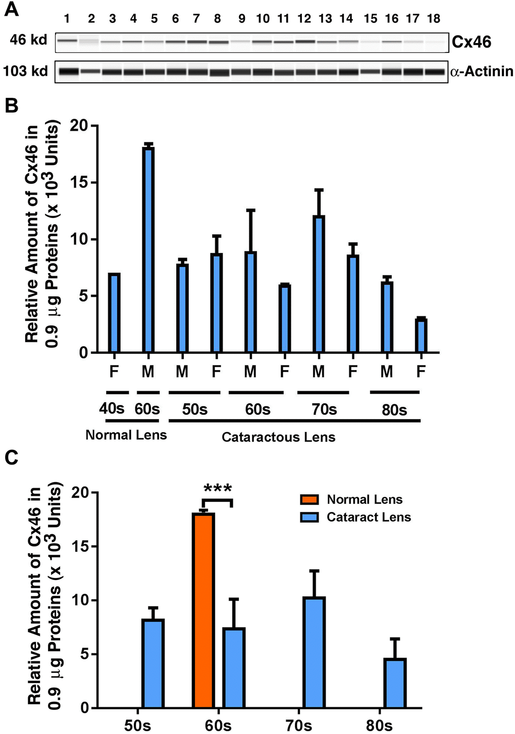 The automated western immunoblot (AWI) analyses of connexin 46 (Cx46) in normal and cataractous lenses of different age groups. AWI was performed on a Wes (ProteinSimple) as described recently [48, 56]. Briefly, each sample was loaded with 0.9 μg total protein and then analyzed with the Size Separation Master Kit and Split Buffer (12–230 kDa) according to the manufacturer’s standard instruction using anti-Cx46 antibody (for antibody information, see Experimental Procedures) with a dilution factor of 1:20. The Campass software (Protein Simple, version 4.1.5) was used to program the PeggySue-robot and for presentation (A) and quantification (B–C). Output western blot style data (A) were displayed with exposure time indicated in Figure 1, and the quantification data (B–C) were displayed from the software-calculated average of seven exposures (1–512s). (B) Quantification results show gender difference. Each bar represents an average of 8 samples for cataract lenses but one sample for normal human lens of 40s and three samples for normal human lenses of 60s. Lanes 1–2 represent normal lenses, and lanes 3–18 represent cataractous lenses of different age groups (3–6, 50s; 7–10, 60s; 11–14, 70s and 15–18, 80s). (C) Quantification results show age difference. ***p 