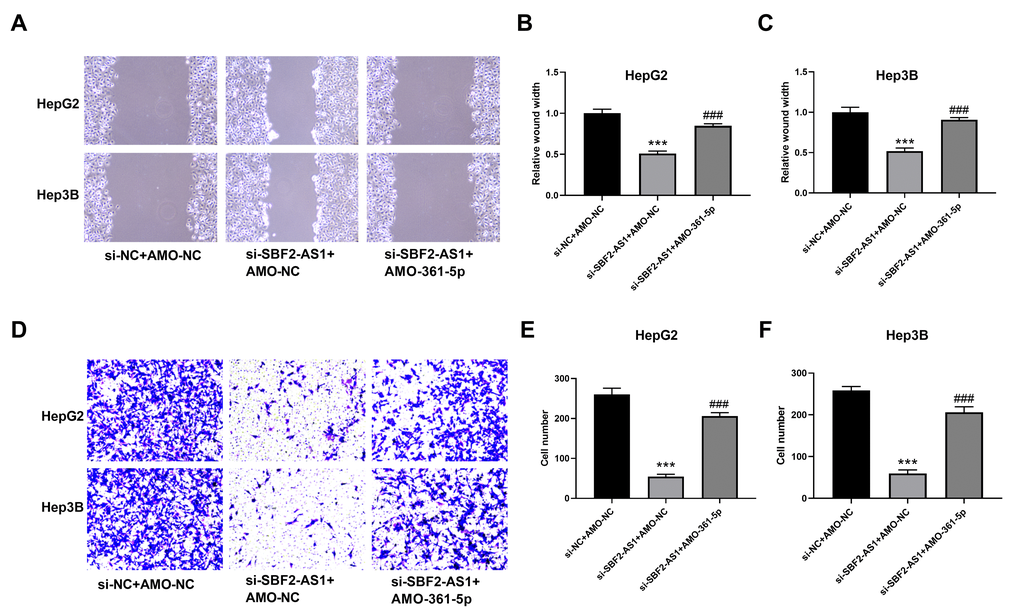 Suppression of miR-361-5p attenuates the influence of lncRNA SBF2-AS1 downregulation on the migration of HCC cells. (A) Representative images of HepG2 and Hep3B cells. (B) Migration distance of HepG2 cells. (C) Cell migration distance of Hep3B cells. (D) Representative BCCMY images of HepG2 and Hep3B cells. (E) The number of migrating HepG2 cells. (F) The number of migrating HepG2 cells. *** P A–C), n=6; (D–F), n=3.
