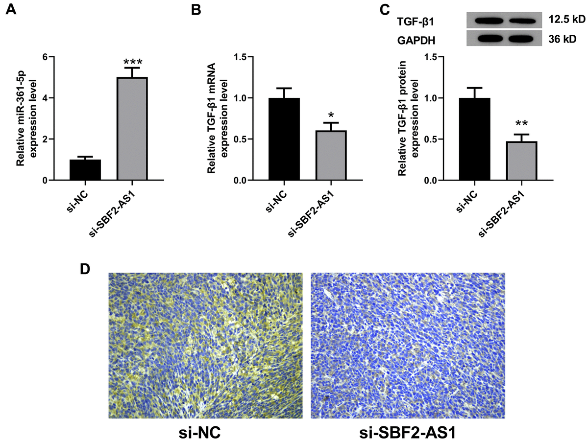Levels of miR-361-5p and TGF-β1 after lncRNA SBF2-AS1 knockdown in an XMM of HCC. (A) The level of miR-361-5p in HCC tissues. (B) The level of TGF-β1 mRNA in HCC tissues. (C) The level of TGF-β1 protein in HCC tissues. (D) The representative immunohistochemistry images of TGF-β1. The obtained data are expressed through mean ± SEM. * P 