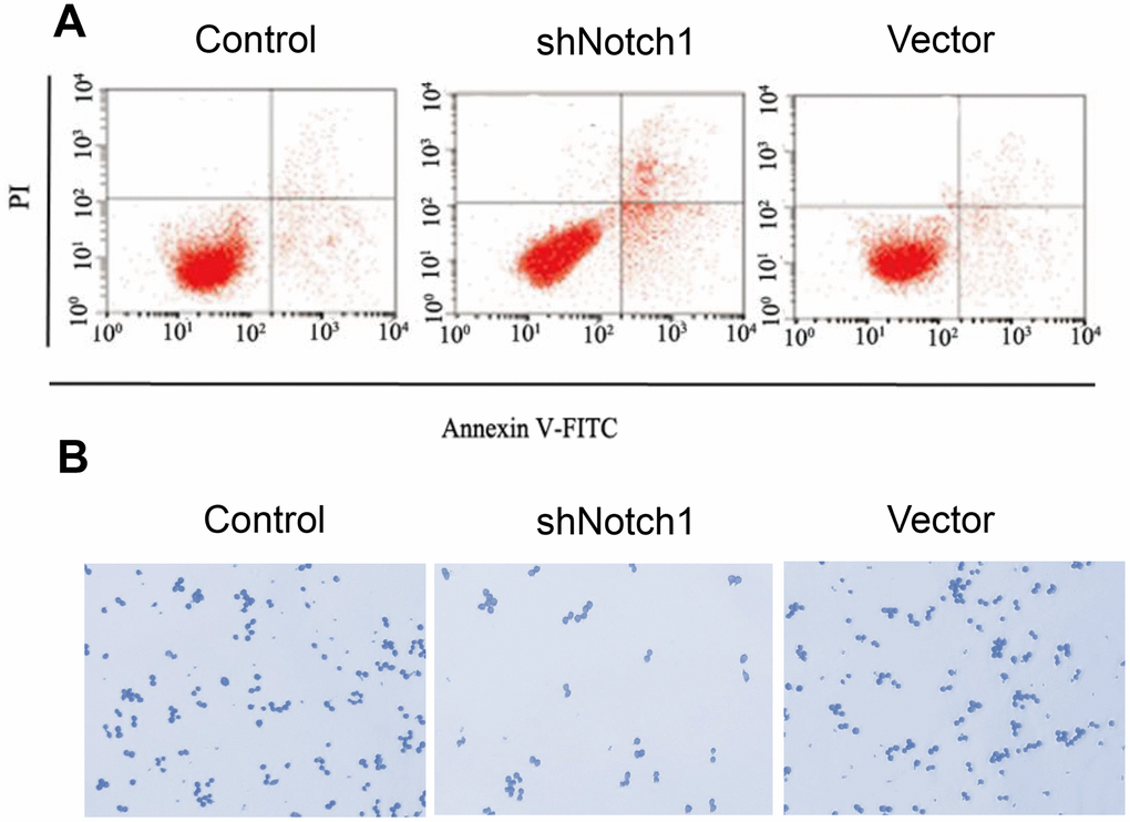 shNotch1 induced osteosarcoma cell apoptosis and cell proliferation. (A) shNotch1 treatment induced up-regulated osteosarcoma cell apoptosis. (B) shNotch1 treatment induced up-regulated osteosarcoma cell colony formation.