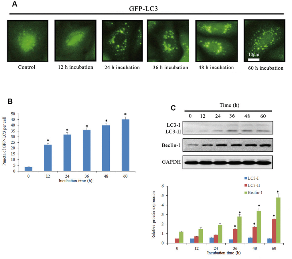 Notch1 induced autophagy in human osteosarcoma cells. (A) Osteosarcoma cells were transiently transfected with GFP-LC3 plasmid for 24 h and then treated with doxycycline (10 μM) for 0, 12, 24, 36, 48 and 60 h. Doxycycline treated cells displayed a punctate pattern of GFP-LC3 expression, which represented formation of autophagosomes. (B) The histogram indicated that autophagy proportion from three separate experiments in different groups. *PC) Autophagy-related proteins, LC3 and beclin-1, were analyzed by western blotting. *P