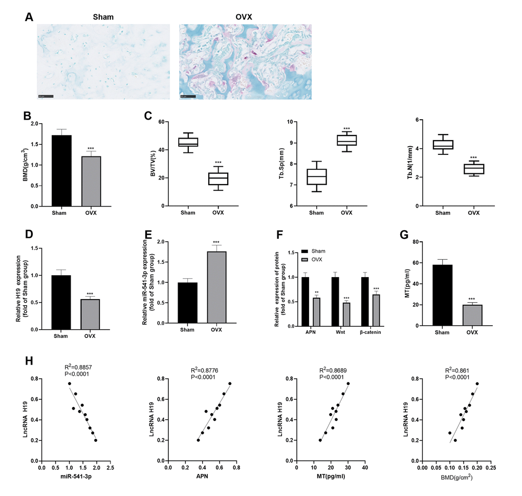 H19 and APN were down-regulated, while miR-541-3p was up-regulated in OP rats. (A) TRAP staining was performed to label osteoclasts. Scale: 50 μm. (B, C) Expression of BMD, BV/TV, Tb. SP and Tb.N in mandibular tissues of the OP rat model. (D, E) The levels of H19 and miR-541-3p in mandibular tissues of the OP rat model were examined by qRT-PCR. (F) WB was implemented to verify the protein levels of APN and Wnt/β-catenin in mandibular tissues of the OP rat model. (G) MT content in the caudal vein of the OP rat model was detected by ELISA. *** P H) Person linear regression analysis was used to determine the correlation between H19 and miR-541-3p, APN, MT and BMD. R2 = 0.8857, P R2 = 0.8776, P R2 = 0.8689, P R2 = 0.8610, P 