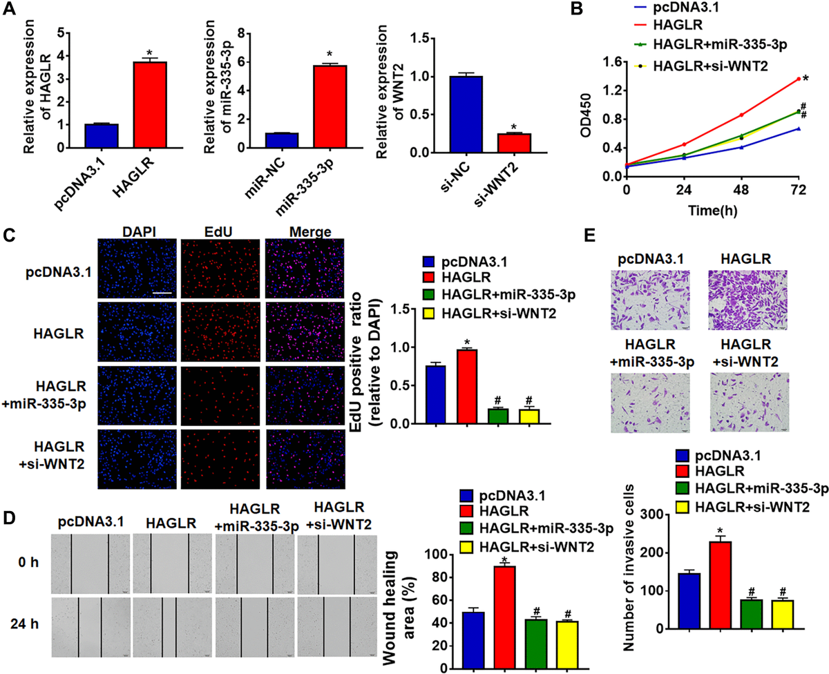 HAGLR promoted TNBC growth through miR-335-3p/WNT2 axis. HAGLR was transfected into BT549 cells with miR-335-3p or si-WNT2. (A) The transfection efficiency was detected using qRT-PCR. (B) CCK8 assay for cell viability of BT549 cells. (C) EdU assay for cell proliferation of BT549 cells. Scale bar, 100 μm. (D) Wound healing assay for cell migration of BT549 cells. Scale bar, 100 μm. (E) Transwell assay for cell invasion of BT549 cells. Scale bar, 50 μm. Data are mean ± SD; *P #P 