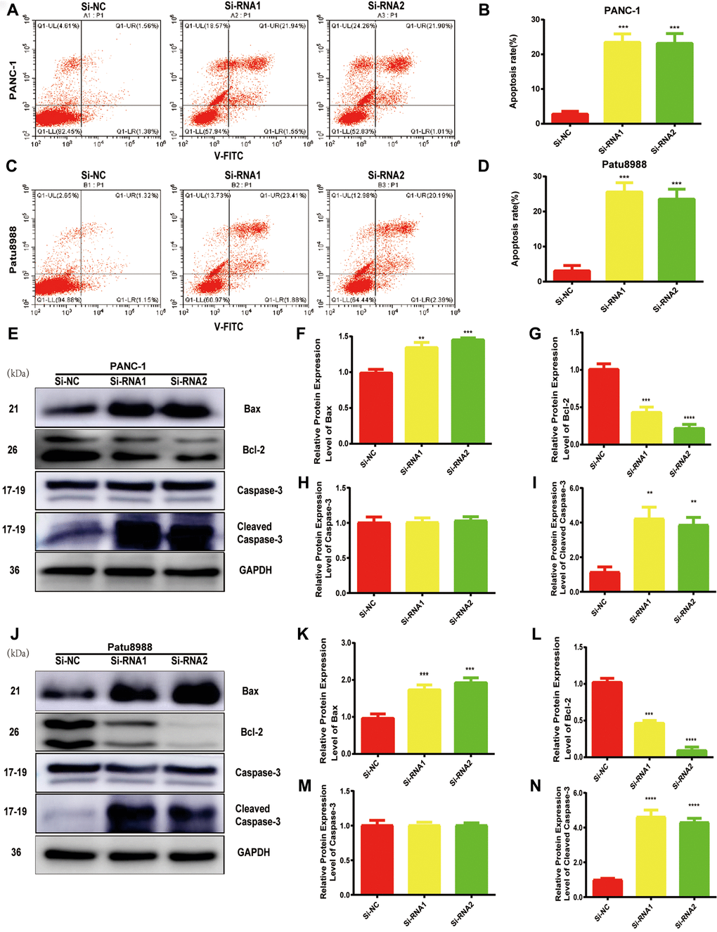 NUDCD1 knockdown induced the apoptosis of PC cells. (A–D) Flow cytometric analysis revealed that NUDCD1 knockdown increased the rate of apoptosis in Patu8988 and PANC-1 cells. (E–N) Western blot analysis showed that NUDCD1 knockdown decreased the expression of Bcl-2 and increased the expression of Bax and Cleaved Caspase-3 in PANC-1 and Patu8988 cells. **p