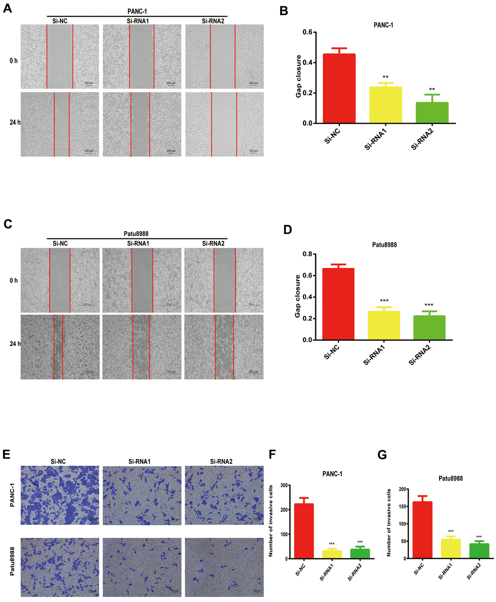 NUDCD1 knockdown suppressed the invasion and migratory abilities of PC cells. (A–D) NUDCD1 knockdown inhibited the migration of Patu8988 and PANC-1 cells in the wound healing assay. (E–G) NUDCD1 knockdown inhibited the invasion of PANC-1 and Patu8988 cells in the transwell assay. **p