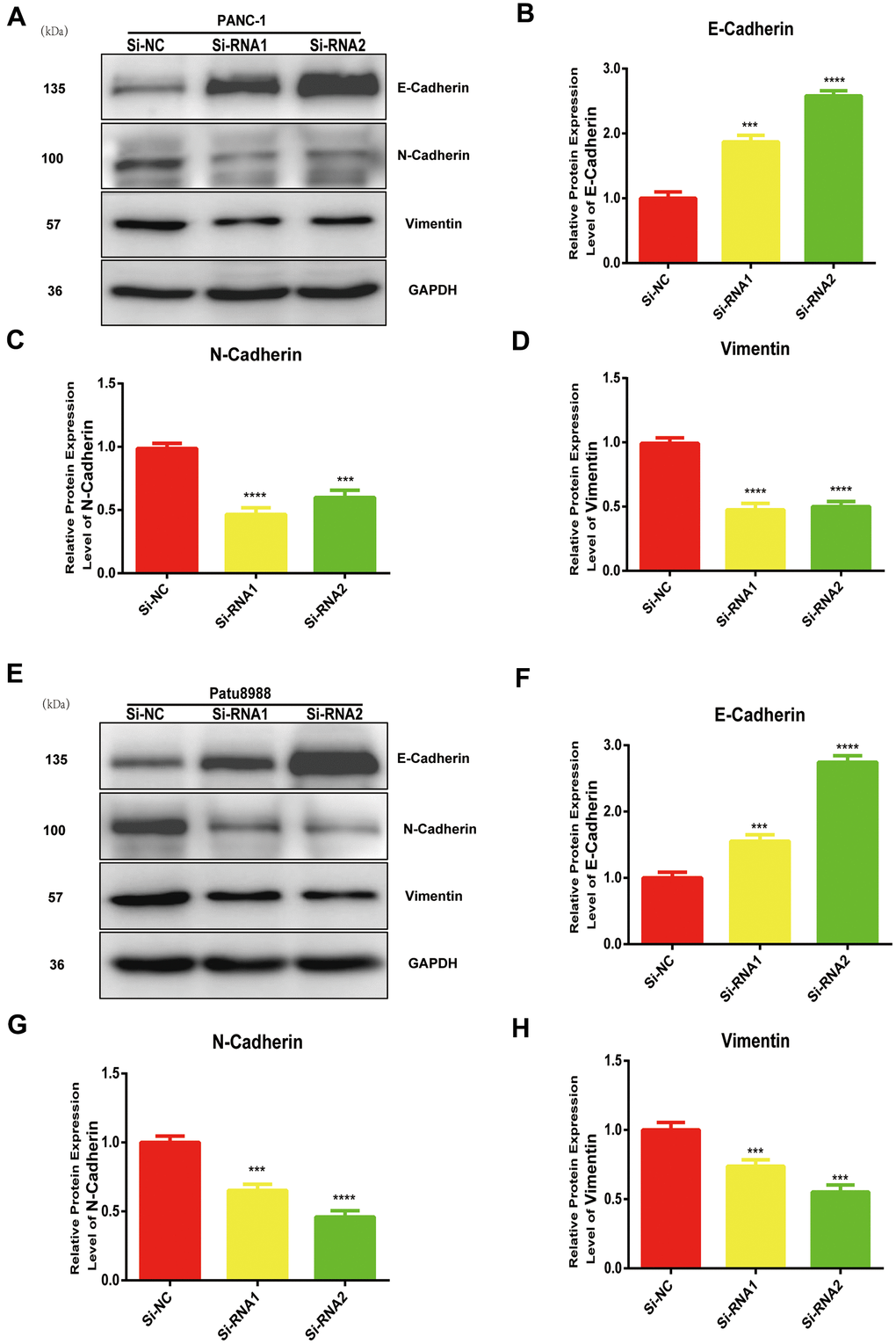 NUDCD1 knockdown inhibited the EMT process in PC cells. (A–D) NUDCD1 knockdown decreased the expression of N-cadherin and vimentin and upregulated the expression of E-cadherin in PANC-1 cells. (E–H) NUDCD1 knockdown decreased the expression of N-cadherin and vimentin, and upregulated the expression of E-cadherin in Patu8988 cells. ***p