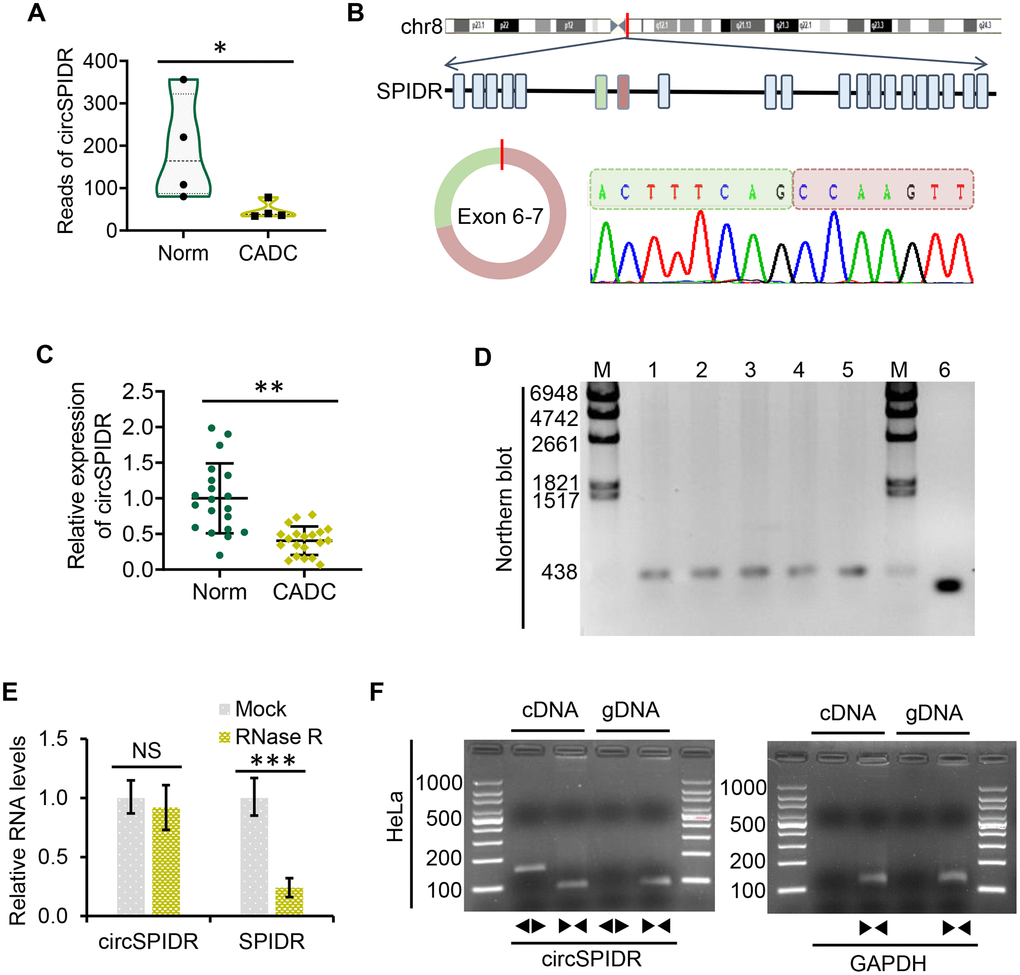 Characterization and validation of circSPIDR expression in CADC. (A) Violin plot showing the distribution of the RNA sequencing reads of circSPIDR in normal cervical tissues (Norm) and CADC tissues. (B) The genomic locus and generation of circSPIDR. CircSPIDR is produced from exons 6 and 7 of the human SPIDR gene. The back-splice junction sequence of circSPIDR was detected using Sanger sequencing. (C) qRT-PCR analysis of circSPIDR expression in 20 normal cervical tissues and 20 CADC tissues. (D) Northern blot of circSPIDR. Hybridization was performed with exon 6–7 junction probes. M, RNA marker; 1–3, HeLa cell repeats; 4, CADC tissue; 5, Normal cervical tissue; 6, RT-PCR products of probes. (E) qRT–PCR analysis of circSPIDR expression and SPIDR mRNA expression in HeLa cells with or without RNase R treatment. (F) RT-PCR products of circSPIDR and its linear isoform (SPIDR) in cDNA and gDNA from HeLa cells. GAPDH was used as a control. NS, not significant; *P **P ***P 