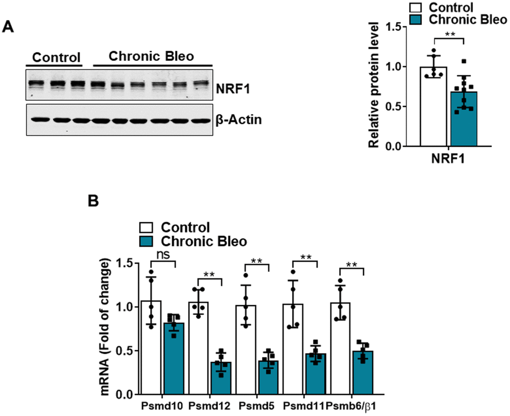 7-day bleomycin protocol reduces NRF-1 expression in alveolar epithelial cells. (A) WB for NRF1 in control and bleomycin injured cells (with β-actin loading control). Densitometry is shown on the right. (B) Transcript levels for PSMD10, PSMD12, PSMD5, PSMD11, and PSMB6/β1 in controls vs. injured MLE12 cells. Statistical significance was assessed by unpaired Student’s t-test for two groups. * p