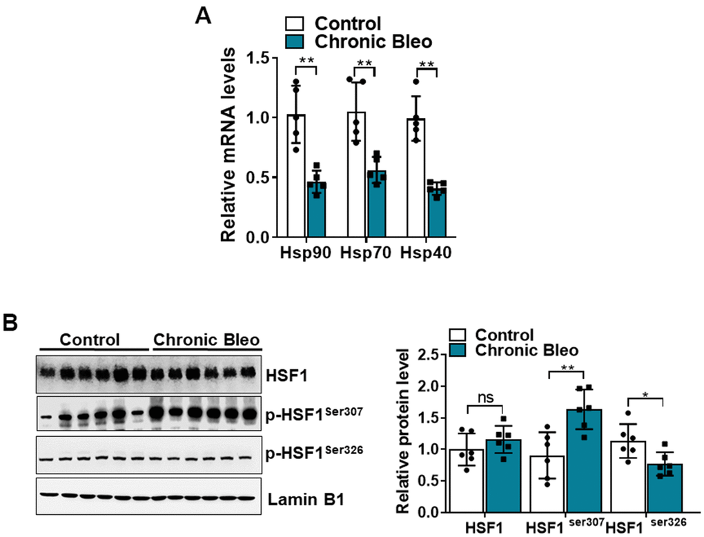 The HSF1 activity is impaired in MLE12 cells after our 7-day injury protocol. (A) Transcript levels for Hsp90, Hsp70, and Hsp40 in control and bleomycin injured MLE12 cells. (B) WB for HSF1, p-HSF1ser307, p-HSF1ser326 in control, and bleomycin injured MLE12 cells (with Laminin-B1 loading control). Densitometry is shown on the right. Results of densitometry analysis are depicted in bar graphs (n= 6, per group). Statistical significance was assessed by unpaired Student’s t-test for two groups. * p
