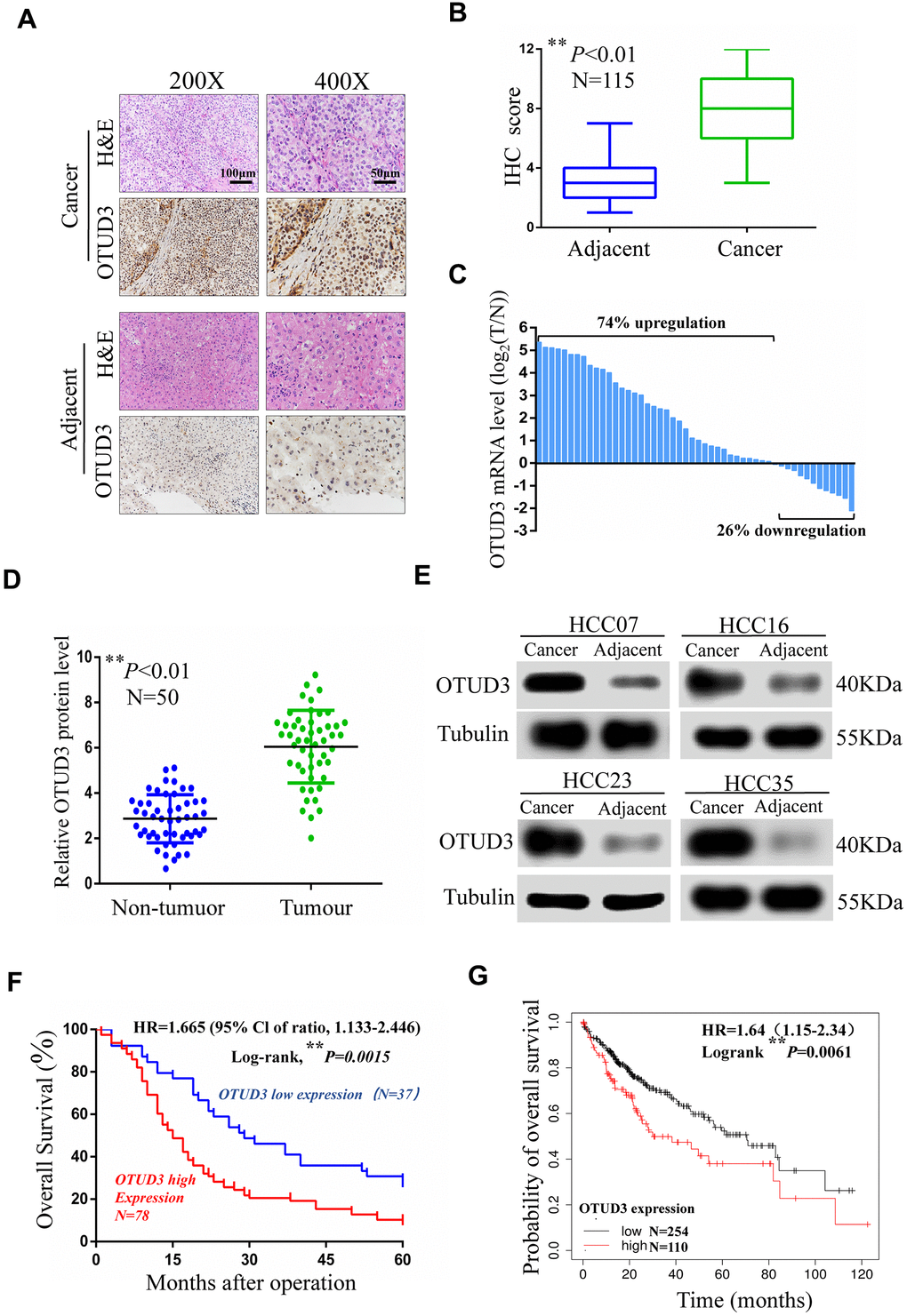 OTUD3 is significantly upregulated in human HCC tissues. (A) Representative images for OTUD3 IHC staining in HCC tissues and corresponding normal tissues (N=115; scale bar: 50μm, 100μm). (B) Diagram of OTUD3 staining score in IHC staining. (C) qRT-PCR analysis of OTUD3 mRNA level in 50 cases of HCC tissues and corresponding normal tissues. Left, a log 2 (T/N) value> 0 indicates that OTUD3 expression is overexpressed in the HCC samples; right, a log 2 (T/N) valueD) Determination and quantification of OTUD3 protein levels in HCC tissues and paired non-tumour tissues by western blot (N=50). (E) Representative images of western blot. (F) Kaplan–Meier analysis of the correlation between the OTUD3 level and overall survival of HCC patients with high and low OTUD3 expression in the IHC staining. (G) Kaplan–Meier analysis of OTUD3 expression in 364 liver cancer tissues using the Kaplan–Meier plotter website (https://www.kmplot.com). Data were mean ± S.D. of three independent determinations. Student’s t-test was used for P value assessment. *PP