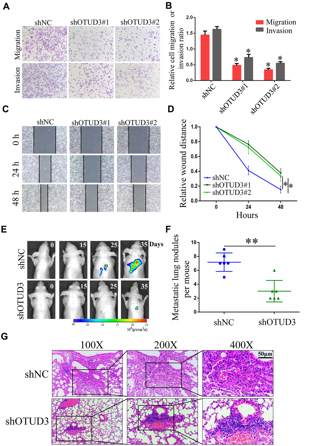 OTUD3 downregulation inhibits HCC cells migration and invasion in vitro and in vivo. (A, B) Invasion and migration assays were employed to evaluate the effect of OTUD3 knockdown on HCCLM3 cells metastatic ability (Magnification 200X). (C, D) Scratching assay was performed to detect migration ability of OTUD3 knockdown HCCLM3 cells compared with the control group. (E) In vivo tumour metastasis was examined using the nude mice (n=6 per group) injected with luciferase-expressing HCCLM3 cells stably transfected with shNC or shRNA targeting OTUD3 and was detected by IVIS from day 0 to day 35. Representative images obtained are shown. (F) Quantification of metastatic lung nodules with shNC and shOTUD3 HCCLM3 cells by tail-vein injection. (G) Images of H&E staining of paraffin-embedded lung tissues from shNC and shOTUD3 nude mice group (Magnification: 100X, 200X, 400X). The unpaired two-sided Student’s t test was used for comparing between two groups of equal variances. Error bars represent mean ± SD from three independent experiments. *PP