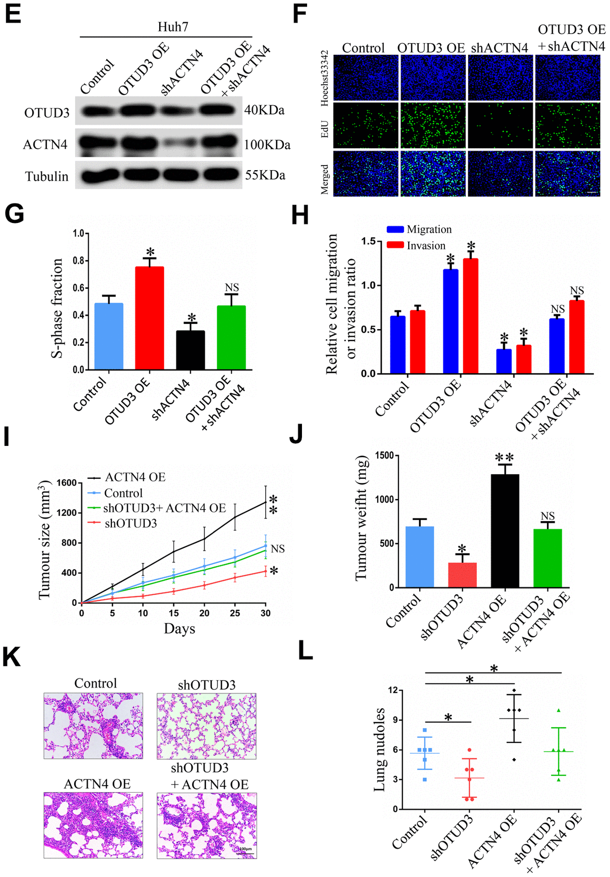 ACTN4 is critical for OTUD3-mediated HCC cells progression in vitro and in vivo. (E) Western blot showing the overexpression of OTUD3 rescued the decreased ACTN4 protein level caused by ACTN4 knockdown. (F, G) EdU assay identifying the effect of OTUD3 upregulation on inhibited HCC cell growth caused by ACTN4 downregulation. (H) Quantification of HCC cell transwell migration and invasion results. (I, J) Tumor sizes and tumor weights of 24 nude mice (6 mice per group) were measured and corresponding tumor growth curves were obtained in the rescue experiments. (K, L) In vivo lung metastasis rescue experiment was examined in 24 nude mice (6 mice per group). Representative H&E staining of lungs are shown (Scale bar: 100μm; magnification: 200X), along with the number of lung metastases in the four groups of nude mice. The unpaired two-sided Student’s t test was used for comparing between two groups of equal variances. Error bars represent mean ± SD from three independent experiments. NS: not significant, *PP