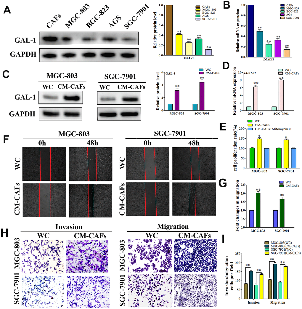 CAFs expression of GAL-1/ LGALS1 promotes the invasion and metastasis ability of GC cell lines in vitro. (A, B) GAL-1 protein and LGALS1 mRNA levels in CAFs and GC cell lines, GAL-1/LGALS1 levels were high in CAFs. (C, D) Treatment of MGC-803 and SGC-7901 cells with CM-CAFs significantly increased GAL-1 protein levels and LGALS1 mRNA expression. (E) CM-CAFs increased the proliferation of MGC-803 and SGC-7901 cells, and the proliferation effect was abolished when the medium contained 10 μg/mL mitomycin C. (F, G) MGC-803 and SGC-7901 cells treated with CM-CAFs exhibited a significantly enhanced migration capacity compared with the wild-type control (P H, I) Transwell assay showing that MGC-803 and SGC-7901 cells treated with CM-CAFs had increased cell invasion and migration abilities (P 