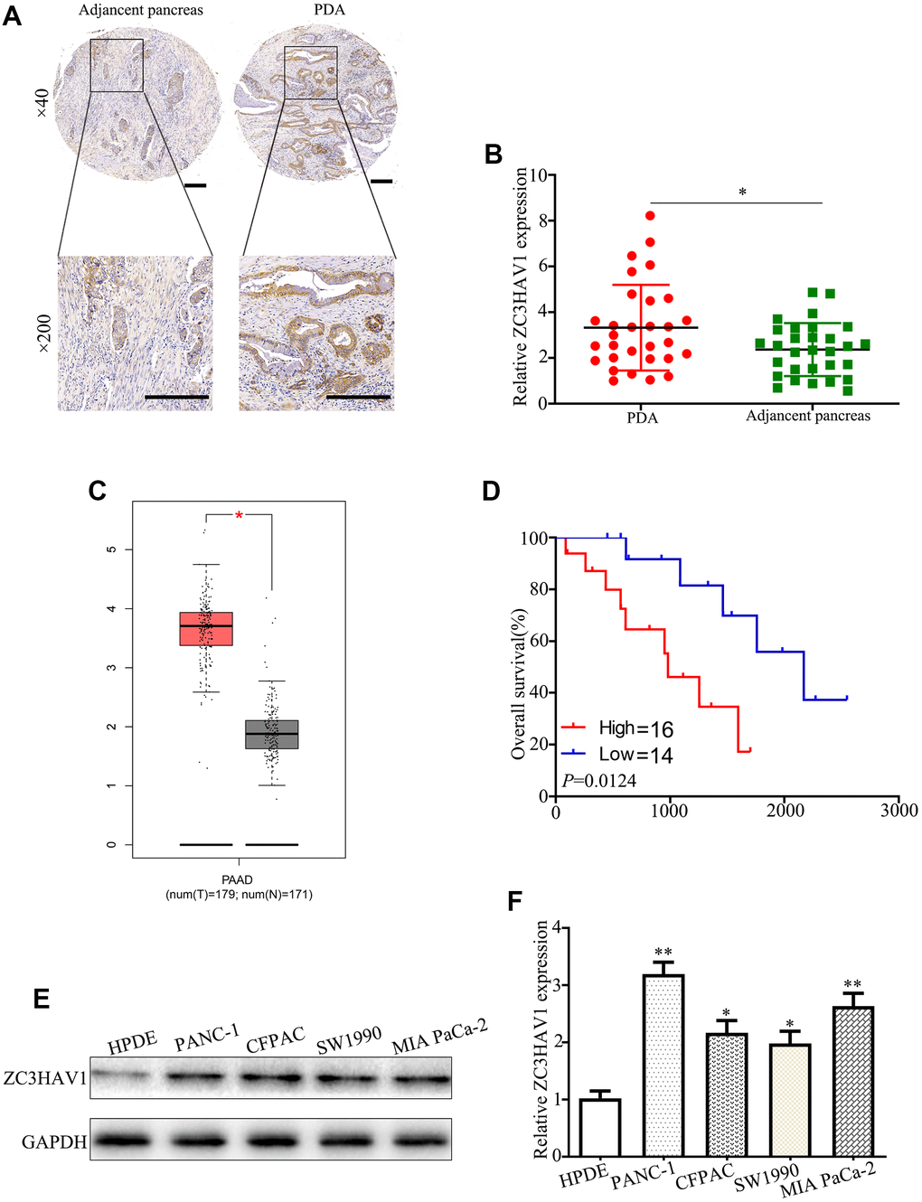 The associated expression of ZC3HAV1 was up-regulated in mankind PC tissues and cells and demonstrated poor prognosis. (A) Representative IHC images of ZC3HAV1 expression in PC tissues and matched adjacent non-tumor tissues (n=30) (scar bar: 50 μm). (B) Expression of ZC3HAV1 mRNA in 30 paired PC tissues and adjacent normal tissues was determined by qRT-PCR. (C) The expression of ZC3HAV1 in PC tissues and adjacent normal tissues built on the GEPIA database. (D) Kaplan-Meier survival curve generated in accordance to the ZC3HAV1 expression level. (E, F) The mRNA and protein expression of ZC3HAV1 in PC cell lines and in human pancreas ductal epithelial cell line (HPDE). Data appeared to be average ± SD, *PP