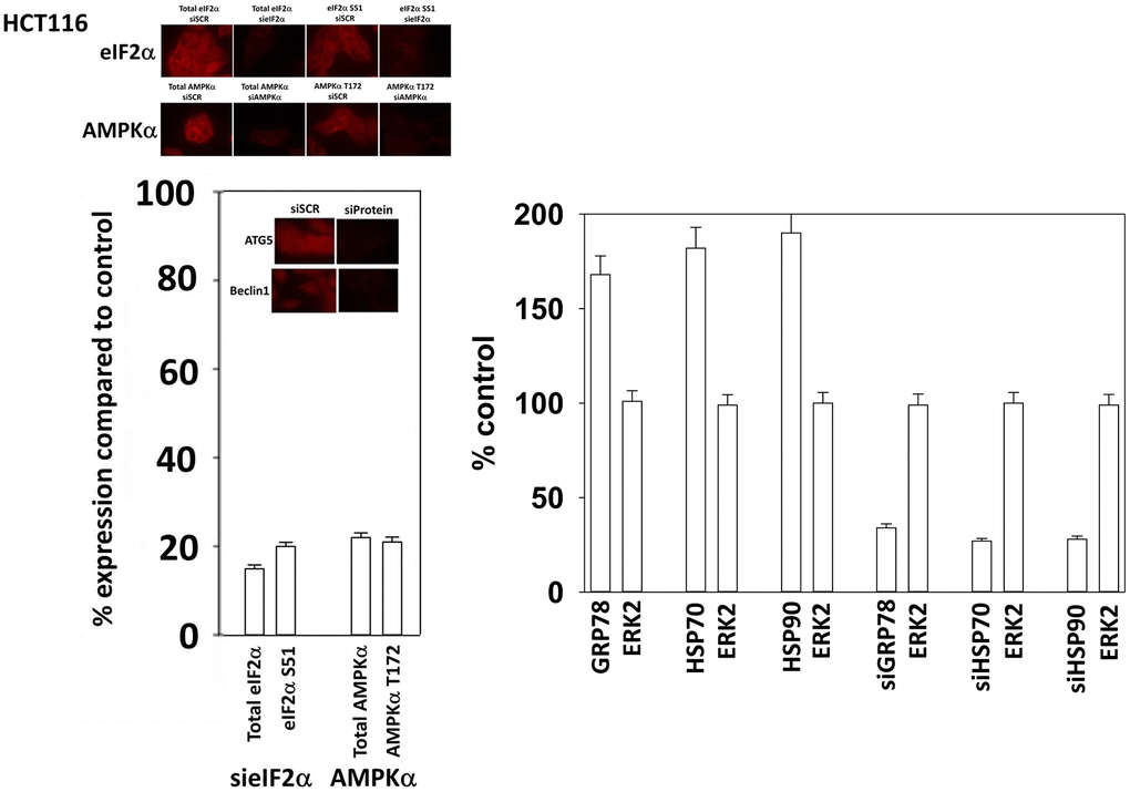 Control studies showing siRNA knockdown of proteins in HCT116 cells. HCT116 cells were transfected with a scrambled control siRNA or siRNA molecules to knock down the expression of eIF2α, AKPKα1, Beclin1 or ATG5. Twenty-four h afterwards, cells were fixed in place and the expression and phosphorylation of the indicated proteins determined.