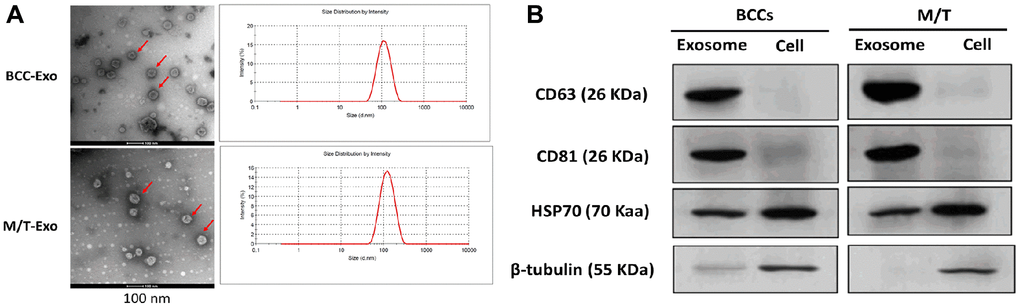 Features of exosomes isolated from breast cancer cells (BCCs) and MCF-7/TAMR-1(M/T) cells. (A) Representative images of exosomes isolated from BCCs and M/T cells, as photographed using the transmission electron microscope and the range of exosome diameter (right column). Scale bar = 500 nm (left column) and 200 nm (middle column). (B) The expressions of exosome markers in BCCs and M/T cells and their exosomes, as detected with western blots.