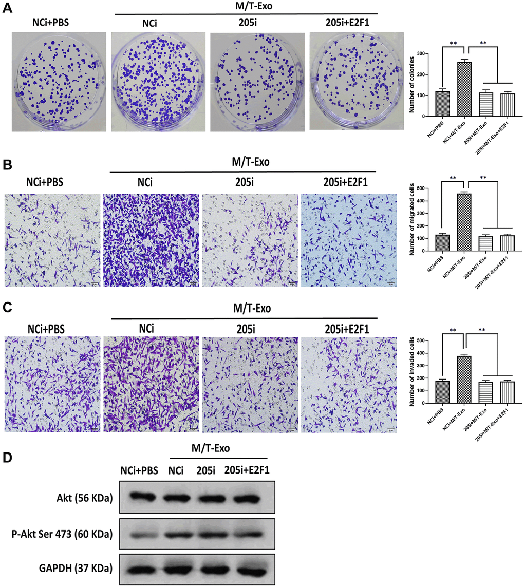 M/T-Exo miRNA-205 affects breast cancer cells (BCCs) proliferation, migration, and invasion via targeting E2F1. (A–C) The abilities of colony formation, migration, and invasion in M/T-Exo-cocultured BCCs treated with the negative control miRNA-205 inhibitor (NCi), miRNA-205 inhibitor (205i), or the combination of 205i and lentiviral vector carrying E2F1 (E2F1). (D) The protein expression of Akt and the phosphorylation of Akt at Ser 473 (p-Akt Ser 473) in M/T-Exo-cocultured BCCs treated with the negative control miRNA-205 inhibitor (NCi), miRNA-205 inhibitor (205i), or the combination of 205i and lentiviral vector carrying E2F1 (E2F1). Values are means ± SD. *P **P ***P 