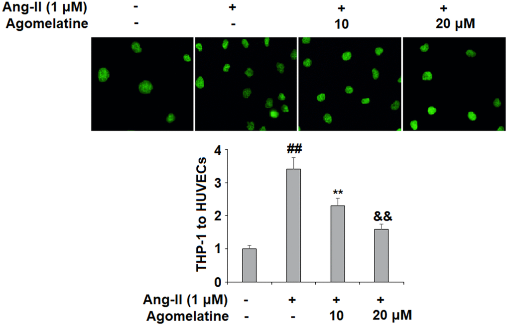 The effects of agomelatine in Ang II-induced attachment of THP-1 monocytes to HUVECs. HUVECs were treated with Ang II (1 μM) with or without agomelatine (10, 20 μM) for 24 h. Calcein-AM staining method was used to measure attachment of THP-1 cells to HUVECs (##, **, &&, P