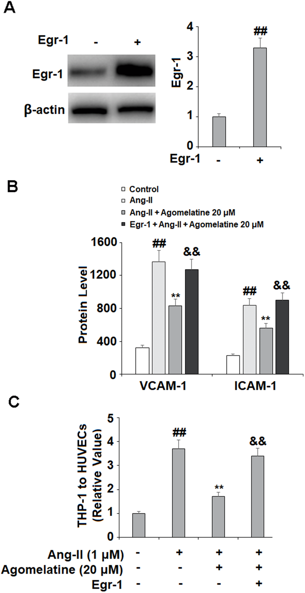 Overexpression of Egr-1 abolished the protective effect of agomelatine against Ang II in HUVECs. HUVECs were transfected with Egr-1 plasmid, followed by stimulation with Ang II (1 μM) with or without agomelatine (20 μM) for 24 h. (A) Successful overexpression of Egr-1; (B) Protein of VCAM-1 and ICAM-1; (C) Calcein-AM staining method was used to measure attachment of THP-1 cells to HUVECs (##, **, &&, P