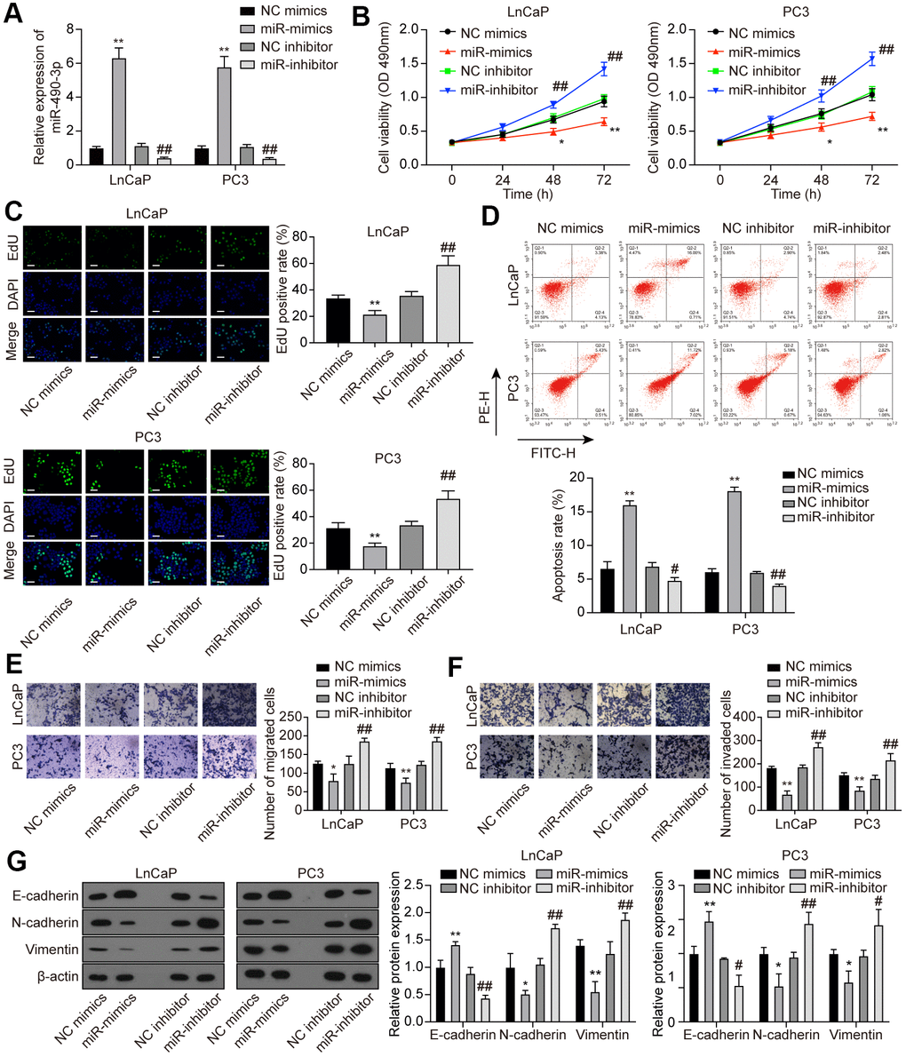 miR-490-3p inhibited cell proliferation, migration, and invasion in PCa cells. (A) Transfection efficiency of miR-490-3p mimics and inhibitor in LnCaP and PC3 cells. Compared to the NC group, PCa cells treated with miR-mimics had higher miR-490-3p expression, while those treated with miR-inhibitor had lower miR-490-3p expression. (B) Cell viability of LnCaP and PC3 cells with different treatments. Cell viability was suppressed in miR-mimics group and promoted in the miR-inhibitor group. (C) EdU staining of LnCaP and PC3 cells with different treatments. Overexpression of miR-490-3p suppressed cell proliferation, while the down-regulation of miR-490-3p promoted cell proliferation in PCa cells. Scale bar: 50 μm. (D) Cell apoptosis detection of LnCaP and PC3 cells with different treatments. Overexpression of miR-490-3p induced cell apoptosis in PCa cells, while the down-regulation of miR-490-3p suppressed the cell apoptosis. (E, F) Cell migration and invasion of LnCaP and PC3 cells in Transwell assays. miR-490-3p mimics treatment suppressed cell migration and invasion while the miR-490-3p inhibitor treatment activated these cell behaviors in PCa cells. (G) miR-490-3p overexpression up-regulated the protein expression of E-cadherin yet decreased the protein expression of N-cadherin and Vimentin, while miR-490-3p inhibition showed the opposite results. *P P P P 