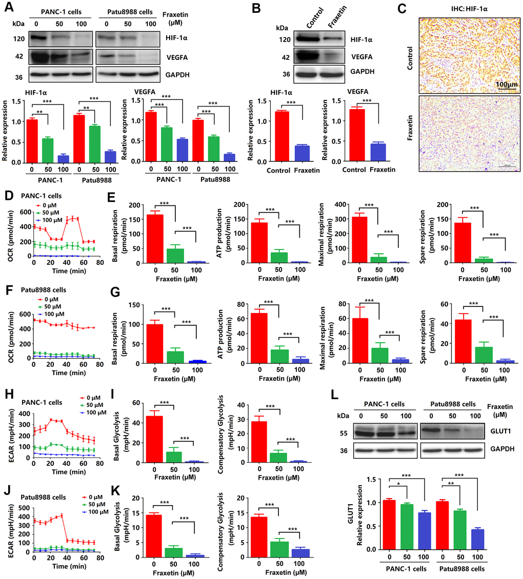 Fraxetin inhibited angiogenesis, glucose metabolism and EMT in PCCs. (A) HIF-1 and VEGFA expression in fraxetin-treated PANC-1 and Patu8988 cells as seen on a Western blot. (B) Western blot analysis of HIF-1 and VEGFA expression in fraxetin-treated animal xenograft models. (C) IHC staining for HIF-1α in fraxetin-treated models. Bar = 100 μm. (D–G) Glucose metabolism assay shows downregulated oxygen consumption rate (OCR), basal respiration, spare respiration, maximal respiration, and ATP production in fraxetin-treated PANC-1 and Patu8988 cells. (H–K) Glucose metabolism assay showing reduced levels of extracellular acidification rate (ECAR), basal glycolysis and compensatory glycolysis in fraxetin-treated PANC-1 and Patu8988 cells. (L) GLUT1 expression in fraxetin-treated PANC-1 and Patu8988 cells as seen on a Western blot. Data were presented as the mean ± standard deviation, and were analyzed by One-way ANOVA with Bonferroni’s post-hoc test and two-sided Student’s t-test. *P **P ***P 