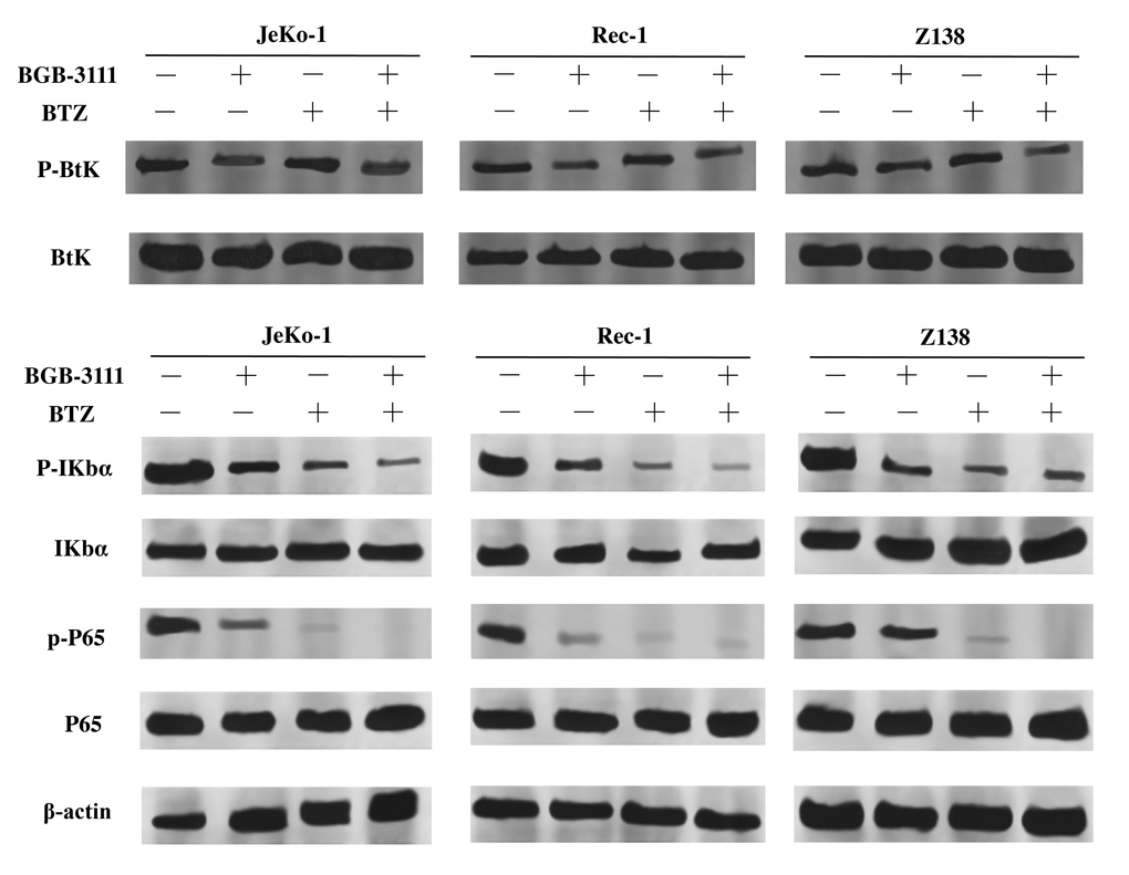 Expression levels of BTK, IκBα, P65 and their phosphorylation proteins in the Jeko-1, Rec-1, and Z138 cells after treating with low-dose BGB-3111, low-dose BTZ, and their combination for 48 h.