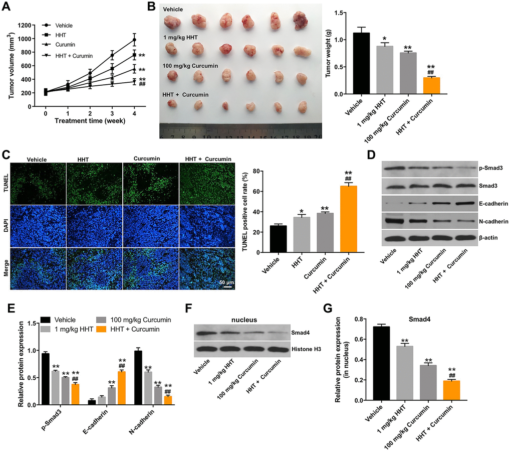 Combination of curcumin with HHT inhibits tumorigenesis in Raji xenografts in vivo. (A) Tumor volume was calculated. (B) Raji xenograft tumors were excised and photographed. Tumor weights were calculated for each group of mice. (C) A TUNEL assay was used to assess cell apoptosis in tumor tissues. (D) p-Smad3, Smad3, E-cadherin and N-cadherin expressions were measured in tumor tissues using Western blotting. (E) Relative p-Smad3, E-cadherin and N-cadherin expressions in tumor tissues normalized to Smad3, β-actin and β-actin. (F, G) Smad4 expression in tumor tissues was measured by Western blotting. Relative Smad4 was determined by normalizing to Histone H3. *P **P ##P 